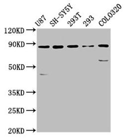 Western Blot. Positive WB detected in: U87 whole cell lysate, SH-SY5Y whole cell lysate, 293T whole cell lysate, 293 whole cell lysate, Colo320 whole cell lysate. All lanes: SLC26A4 antibody at 5.7µg/ml. Secondary. Goat polyclonal to rabbit IgG at 1/50000 dilution. Predicted band size: 86, 40 kDa. Observed band size: 86 kDa