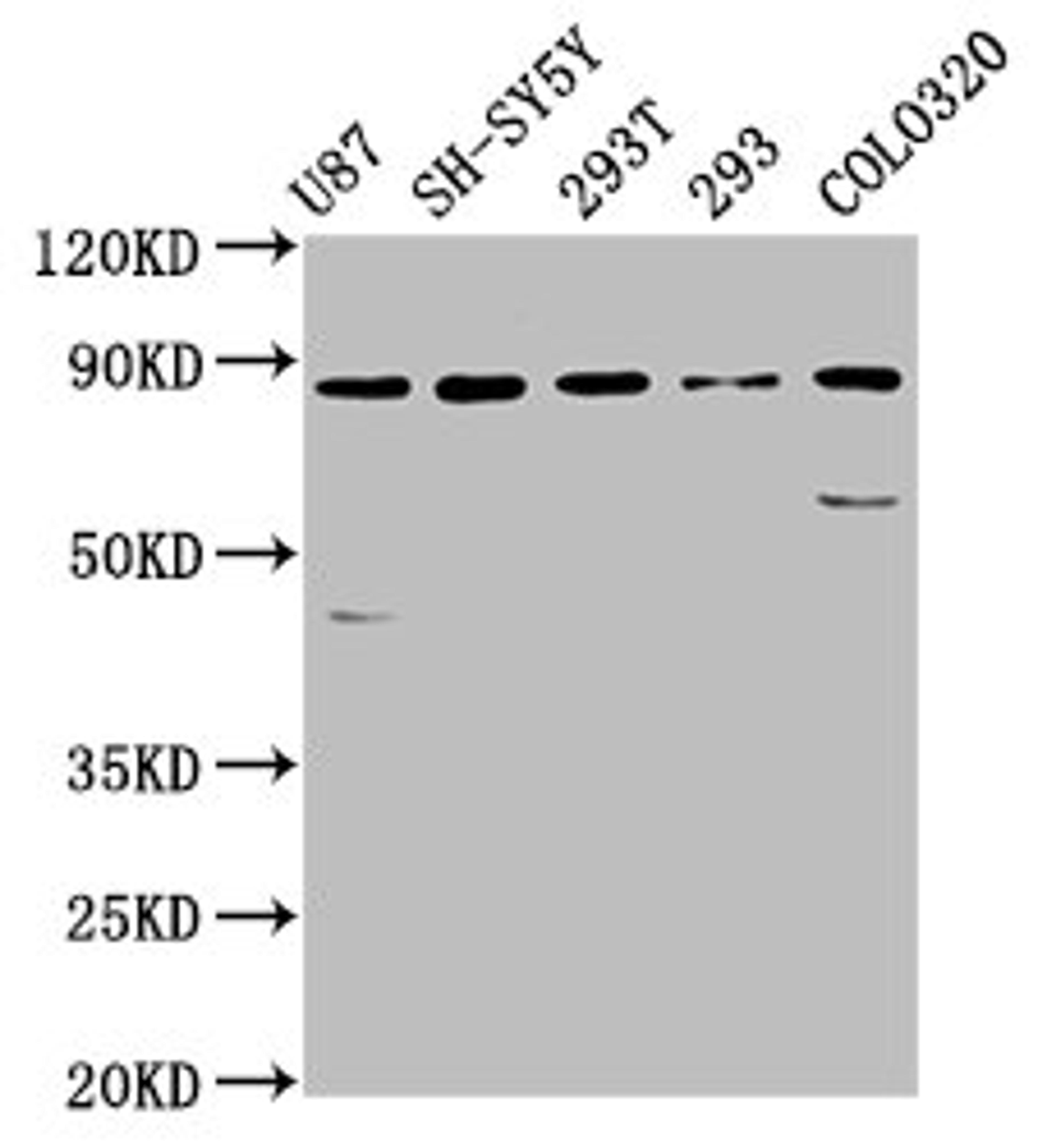 Western Blot. Positive WB detected in: U87 whole cell lysate, SH-SY5Y whole cell lysate, 293T whole cell lysate, 293 whole cell lysate, Colo320 whole cell lysate. All lanes: SLC26A4 antibody at 5.7µg/ml. Secondary. Goat polyclonal to rabbit IgG at 1/50000 dilution. Predicted band size: 86, 40 kDa. Observed band size: 86 kDa