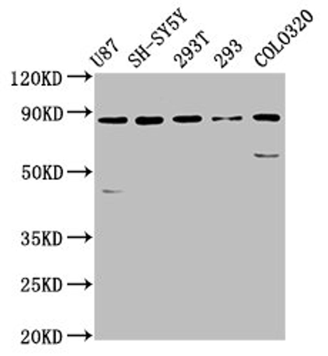 Western Blot. Positive WB detected in: U87 whole cell lysate, SH-SY5Y whole cell lysate, 293T whole cell lysate, 293 whole cell lysate, Colo320 whole cell lysate. All lanes: SLC26A4 antibody at 5.7µg/ml. Secondary. Goat polyclonal to rabbit IgG at 1/50000 dilution. Predicted band size: 86, 40 kDa. Observed band size: 86 kDa