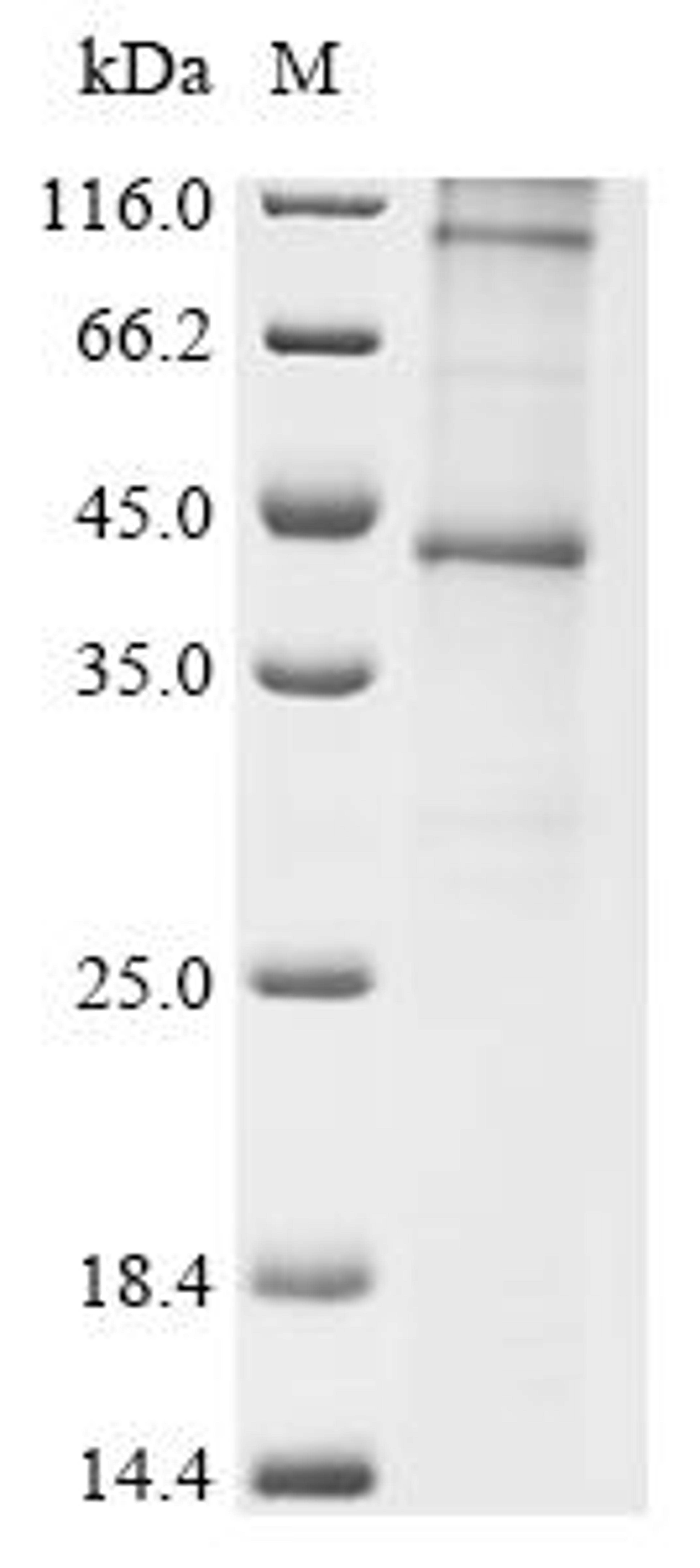 (Tris-Glycine gel) Discontinuous SDS-PAGE (reduced) with 5% enrichment gel and 15% separation gel.