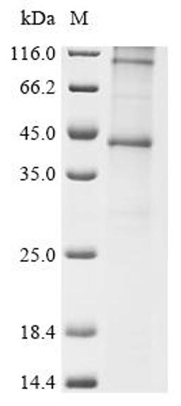 (Tris-Glycine gel) Discontinuous SDS-PAGE (reduced) with 5% enrichment gel and 15% separation gel.