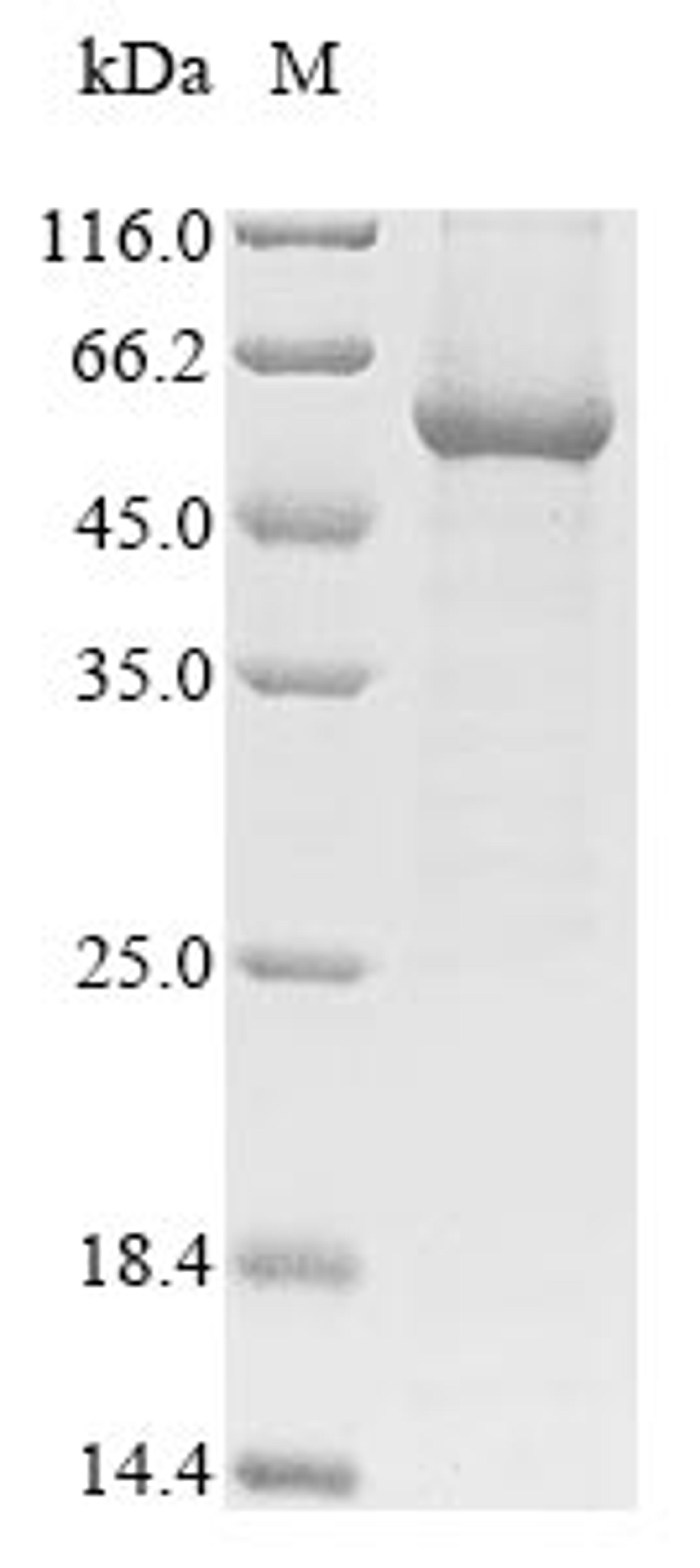 (Tris-Glycine gel) Discontinuous SDS-PAGE (reduced) with 5% enrichment gel and 15% separation gel.