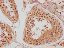 IHC image of CSB-PA845150NA01HU diluted at 1:300 and staining in paraffin-embedded human testis tissue performed on a Leica BondTM system. After dewaxing and hydration, antigen retrieval was mediated by high pressure in a citrate buffer (pH 6.0). Section was blocked with 10% normal goat serum 30min at RT. Then primary antibody (1% BSA) was incubated at 4°C overnight. The primary is detected by a biotinylated secondary antibody and visualized using an HRP conjugated SP system.