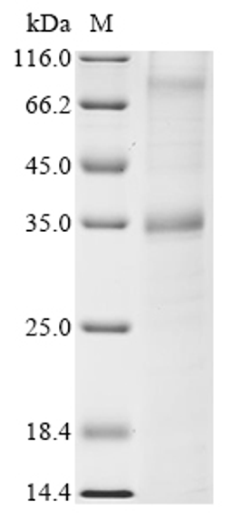 (Tris-Glycine gel) Discontinuous SDS-PAGE (reduced) with 5% enrichment gel and 15% separation gel.