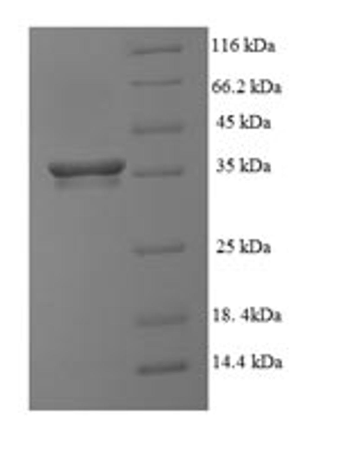 (Tris-Glycine gel) Discontinuous SDS-PAGE (reduced) with 5% enrichment gel and 15% separation gel.