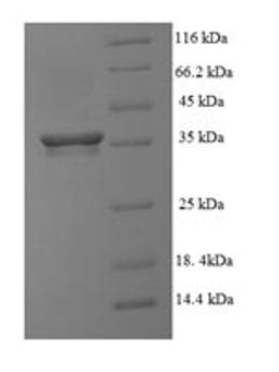 (Tris-Glycine gel) Discontinuous SDS-PAGE (reduced) with 5% enrichment gel and 15% separation gel.