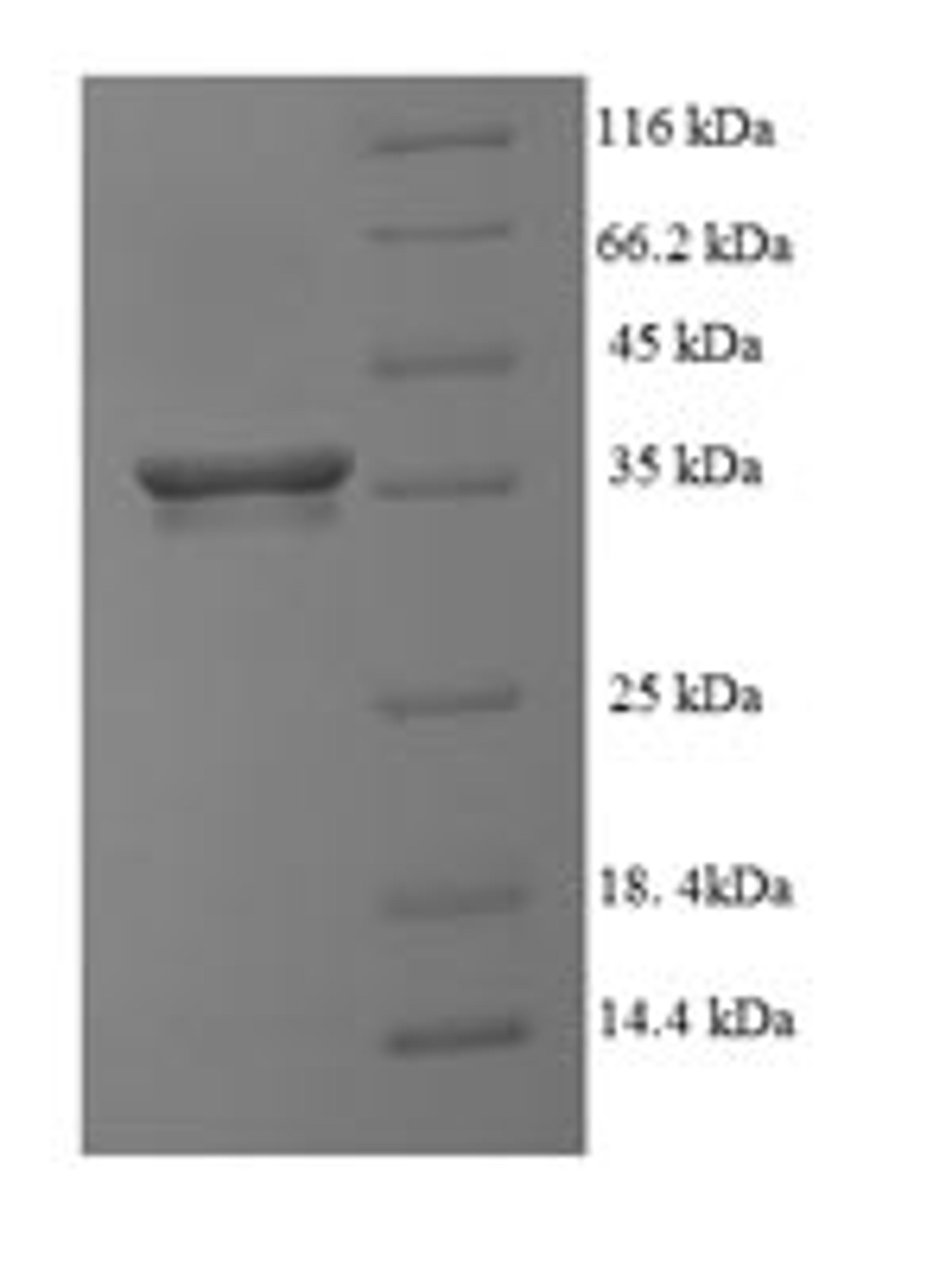 (Tris-Glycine gel) Discontinuous SDS-PAGE (reduced) with 5% enrichment gel and 15% separation gel.