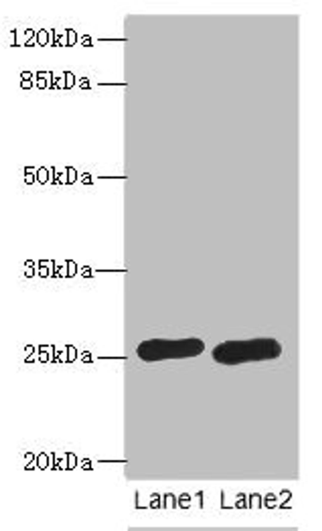 Western blot. All lanes: RAB20 antibody at 0.6ug/ml. Lane 1: HL60 whole cell lysate. Lane 2: U937 whole cell lysate. Secondary. Goat polyclonal to rabbit IgG at 1/10000 dilution. Predicted band size: 26 kDa. Observed band size: 26 kDa. 