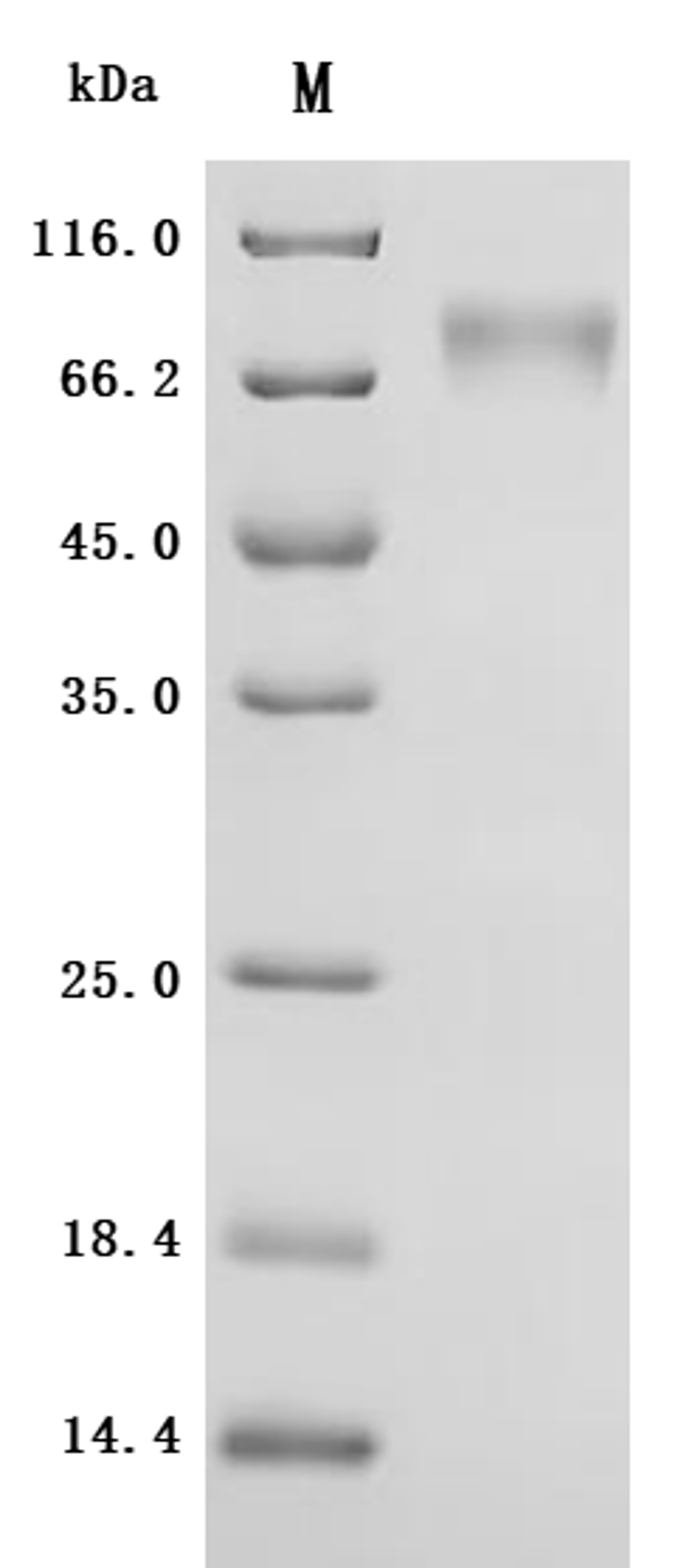 (Tris-Glycine gel) Discontinuous SDS-PAGE (reduced) with 5% enrichment gel and 15% separation gel.