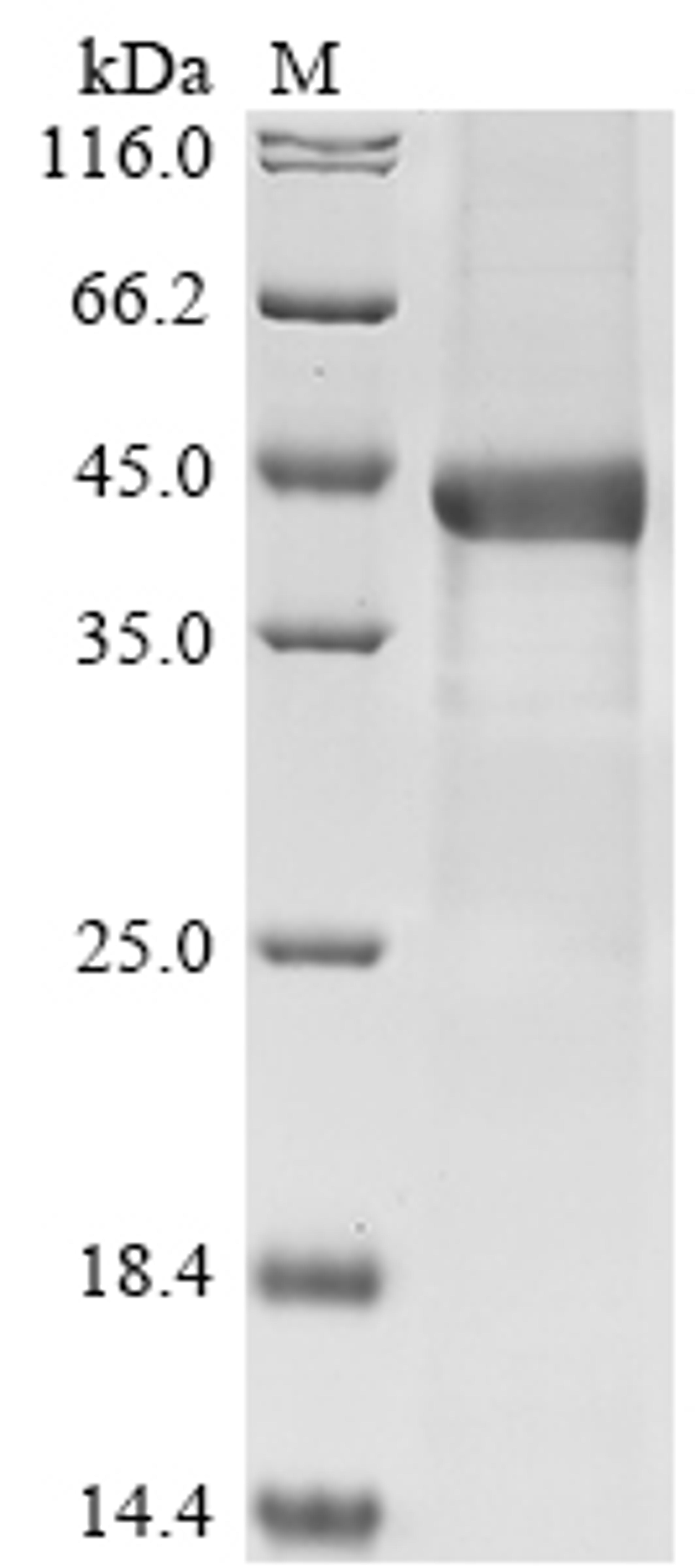 (Tris-Glycine gel) Discontinuous SDS-PAGE (reduced) with 5% enrichment gel and 15% separation gel.