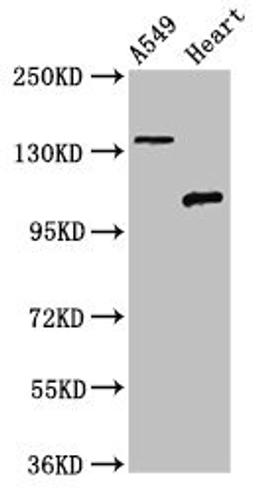 Western Blot. Positive WB detected in: A549 whole cell lysate, Rat heart tissue. All lanes: ADGRA2 antibody at 3ug/ml. Secondary. Goat polyclonal to rabbit IgG at 1/50000 dilution. Predicted band size: 143, 120, 20 kDa. Observed band size: 143, 120 kDa.