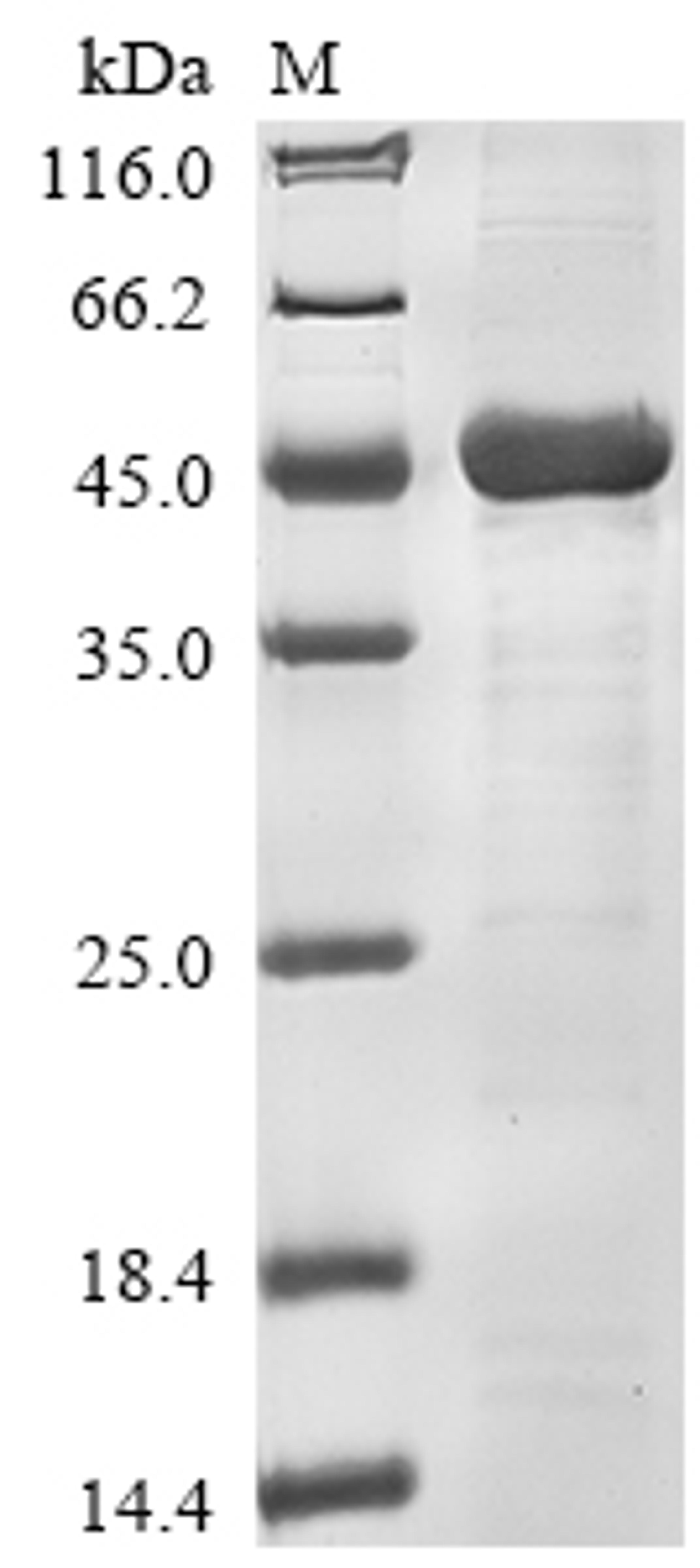 (Tris-Glycine gel) Discontinuous SDS-PAGE (reduced) with 5% enrichment gel and 15% separation gel.
