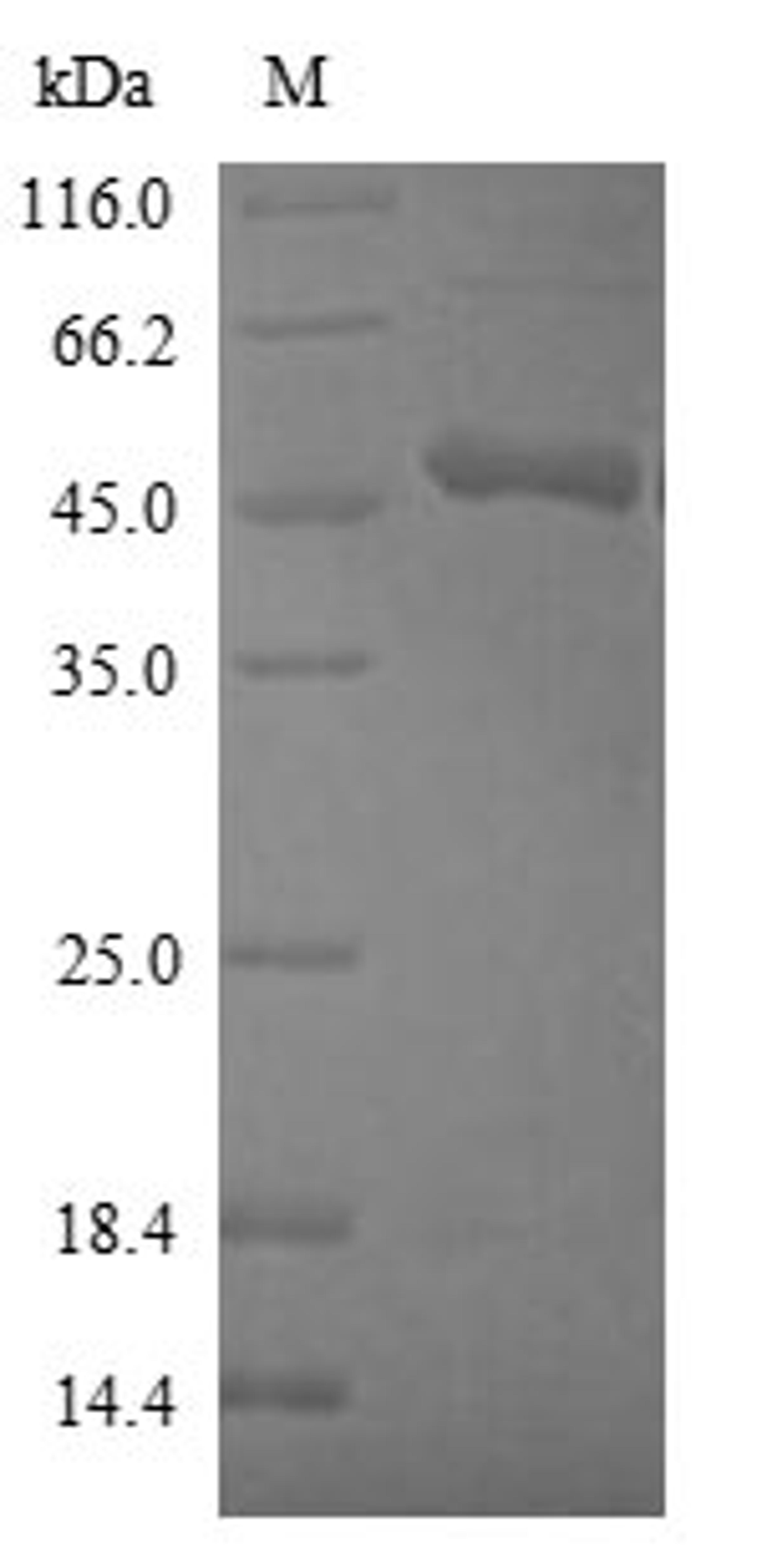 (Tris-Glycine gel) Discontinuous SDS-PAGE (reduced) with 5% enrichment gel and 15% separation gel.
