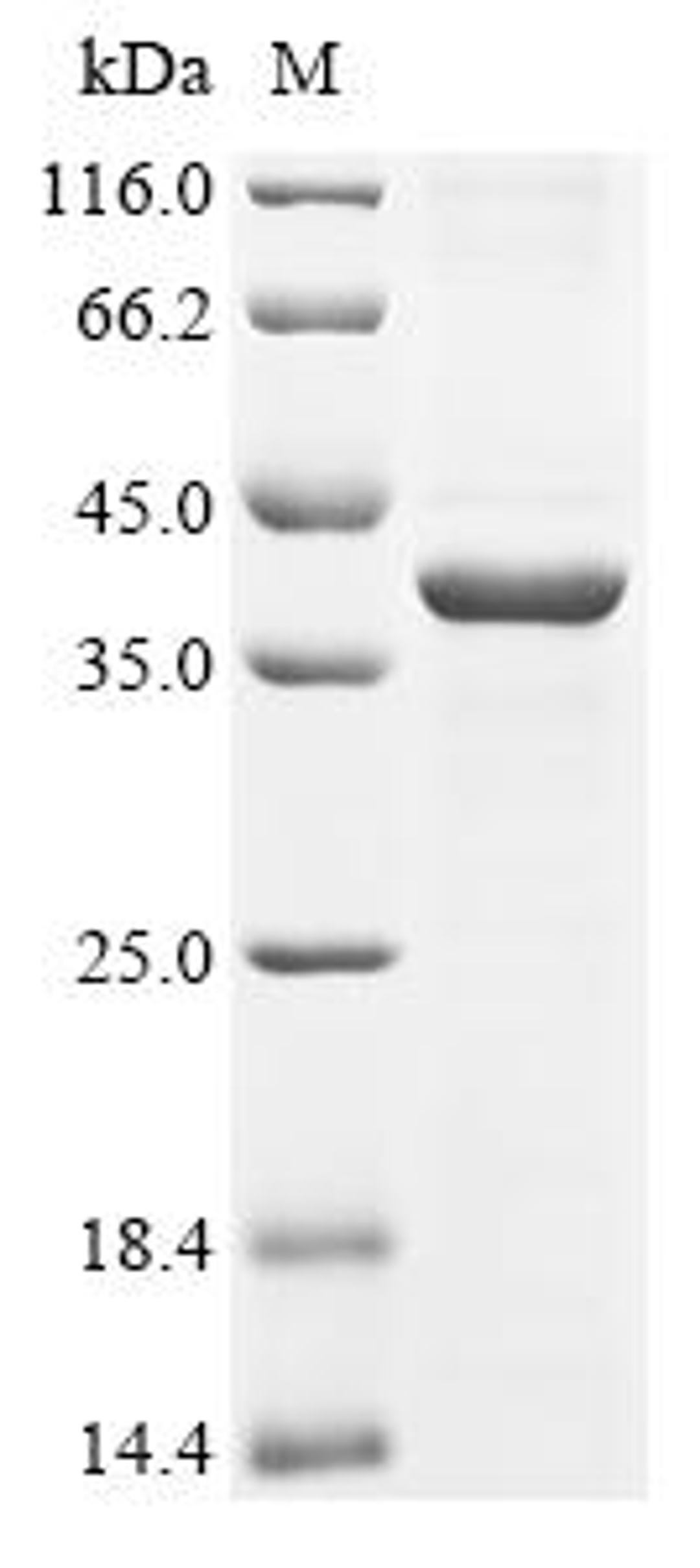 (Tris-Glycine gel) Discontinuous SDS-PAGE (reduced) with 5% enrichment gel and 15% separation gel.