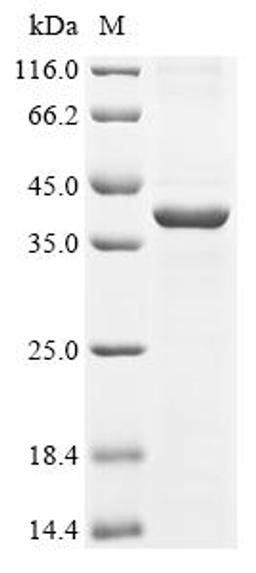 (Tris-Glycine gel) Discontinuous SDS-PAGE (reduced) with 5% enrichment gel and 15% separation gel.