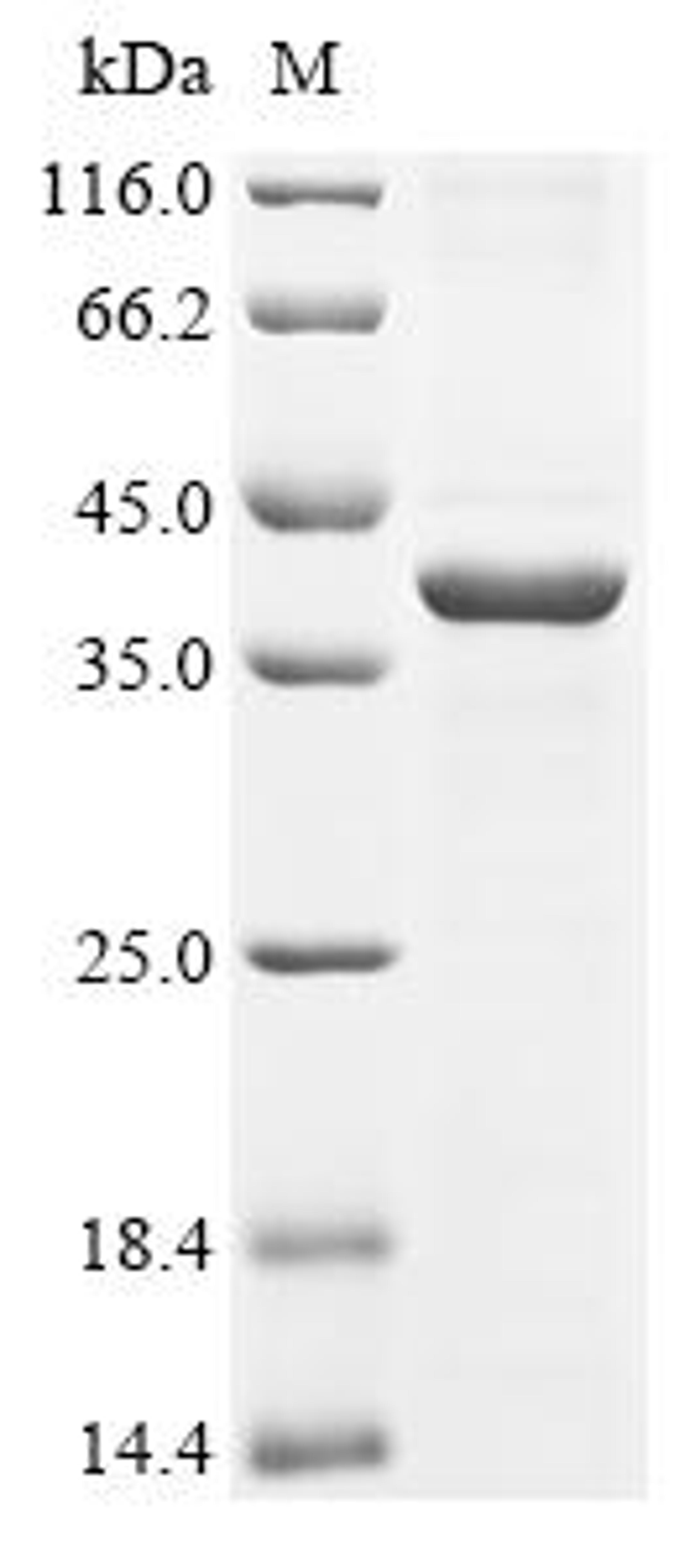 (Tris-Glycine gel) Discontinuous SDS-PAGE (reduced) with 5% enrichment gel and 15% separation gel.