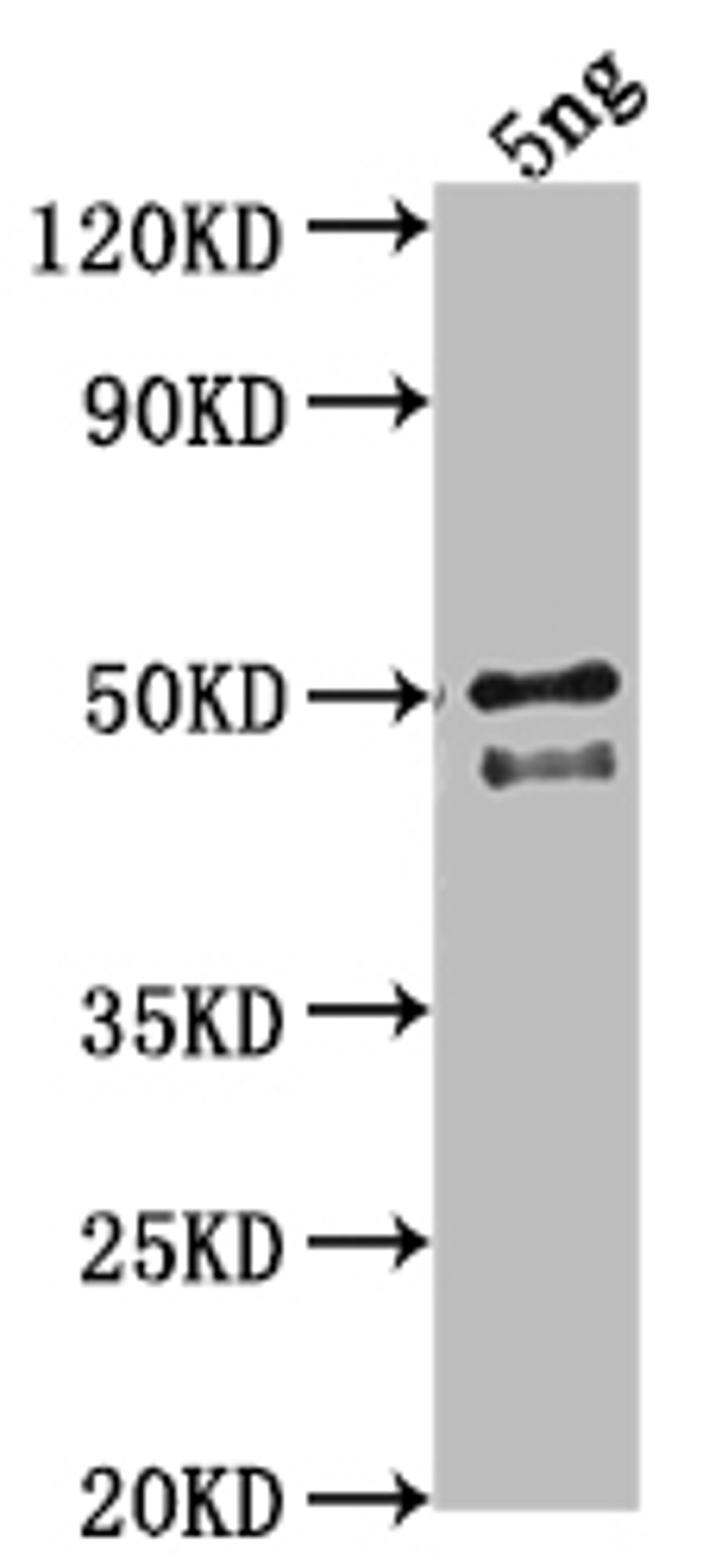 Western Blot. Positive WB detected in Recombinant protein. All lanes: DGAT3 antibody at 1:2000. Secondary. Goat polyclonal to rabbit IgG at 1/50000 dilution. Predicted band size: 43.2 kDa. Observed band size: 44 kDa. 