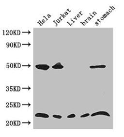 Western Blot. Positive WB detected in: Hela whole cell lysate, Jurkat whole cell lysate, Mouse liver tissue, Mouse brain tissue, Mouse stomach tissue. All lanes: COMMD1 antibody at 3.4ug/ml. Secondary. Goat polyclonal to rabbit IgG at 1/50000 dilution. Predicted band size: 22, 18 kDa. Observed band size: 22, 50 kDa.