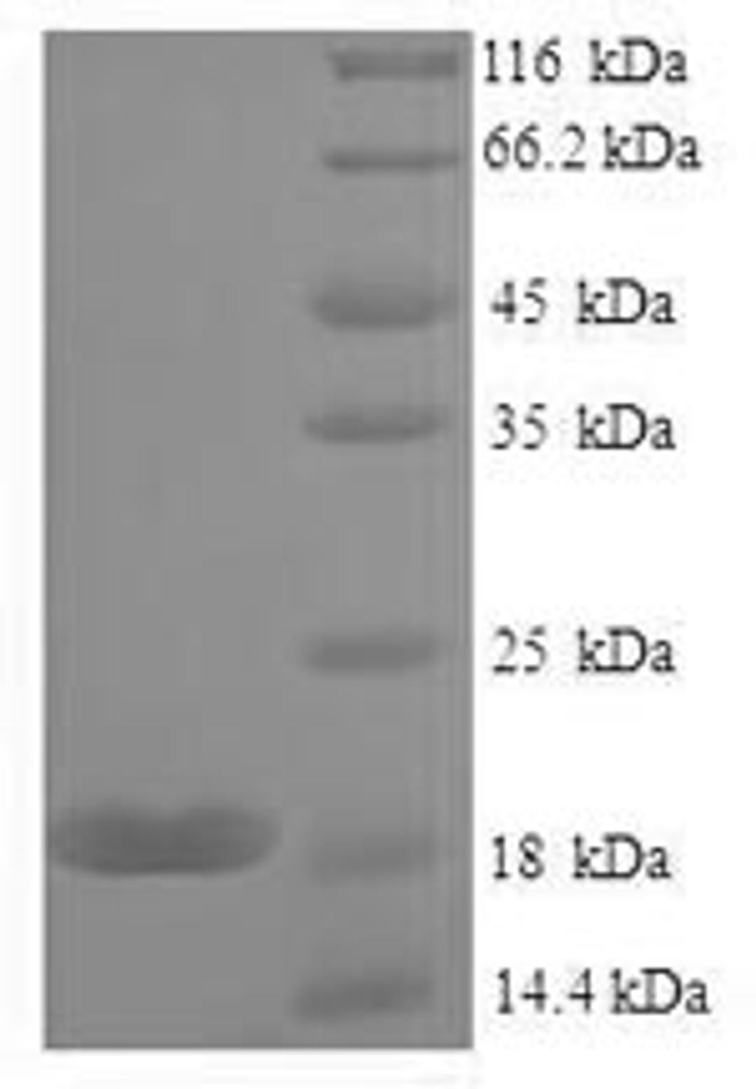 (Tris-Glycine gel) Discontinuous SDS-PAGE (reduced) with 5% enrichment gel and 15% separation gel.