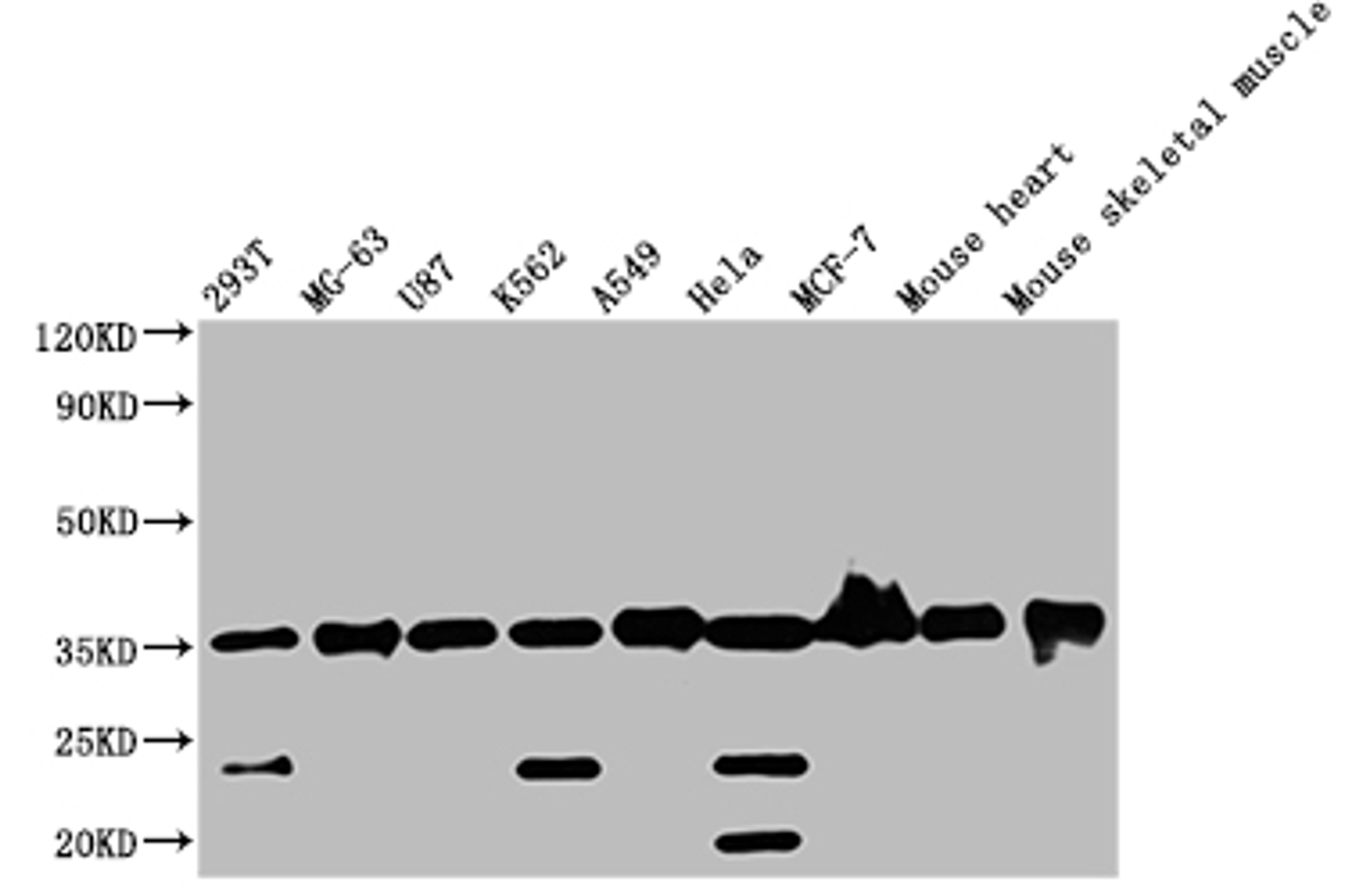 Western Blot. Positive WB detected in: Mouse skeletal muscle tissue. All lanes: ANKRD23 antibody at 2.5µg/ml. Secondary. Goat polyclonal to rabbit IgG at 1/50000 dilution. Predicted band size: 35, 30 kDa. Observed band size: 35 kDa