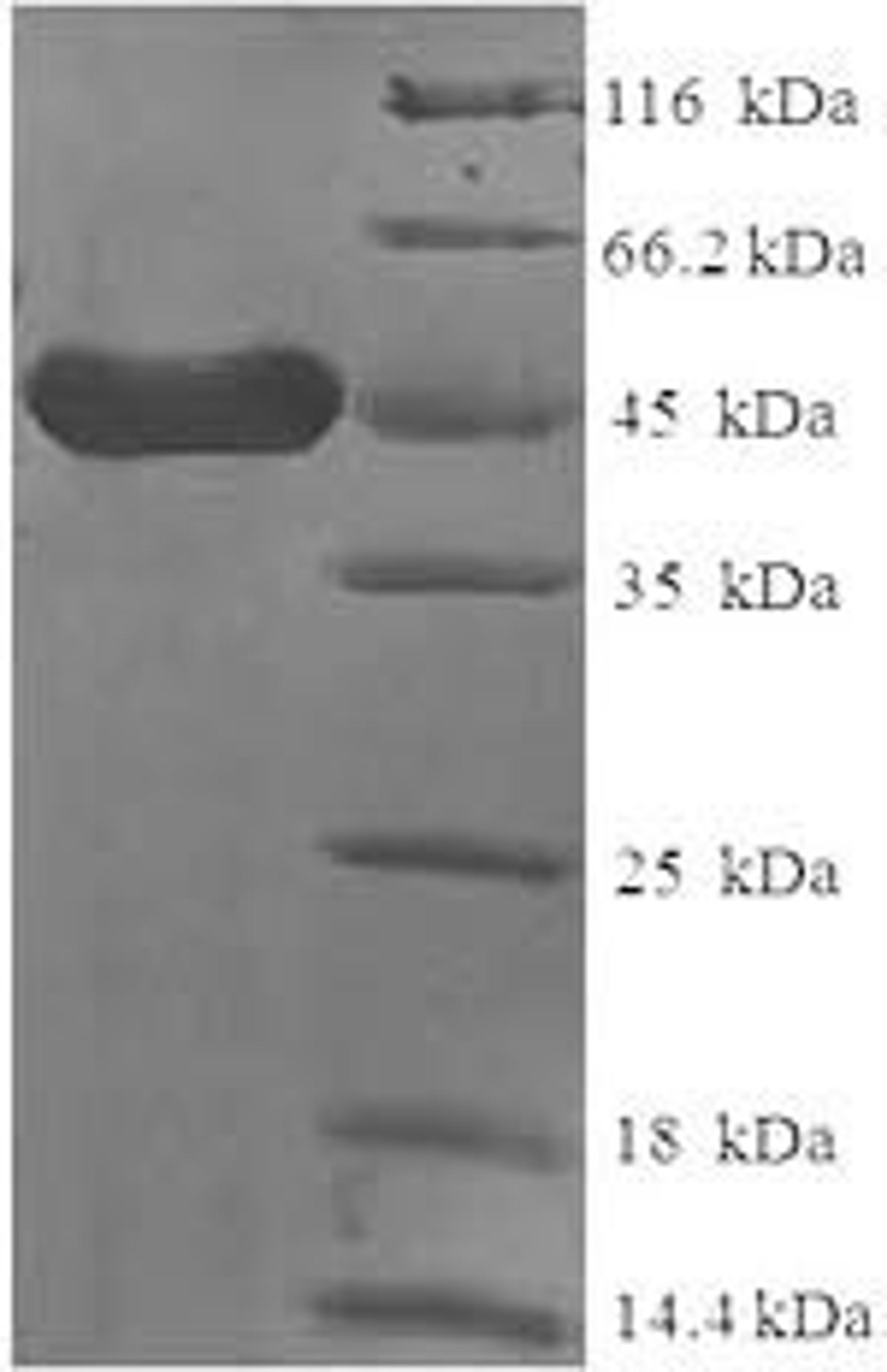 (Tris-Glycine gel) Discontinuous SDS-PAGE (reduced) with 5% enrichment gel and 15% separation gel.