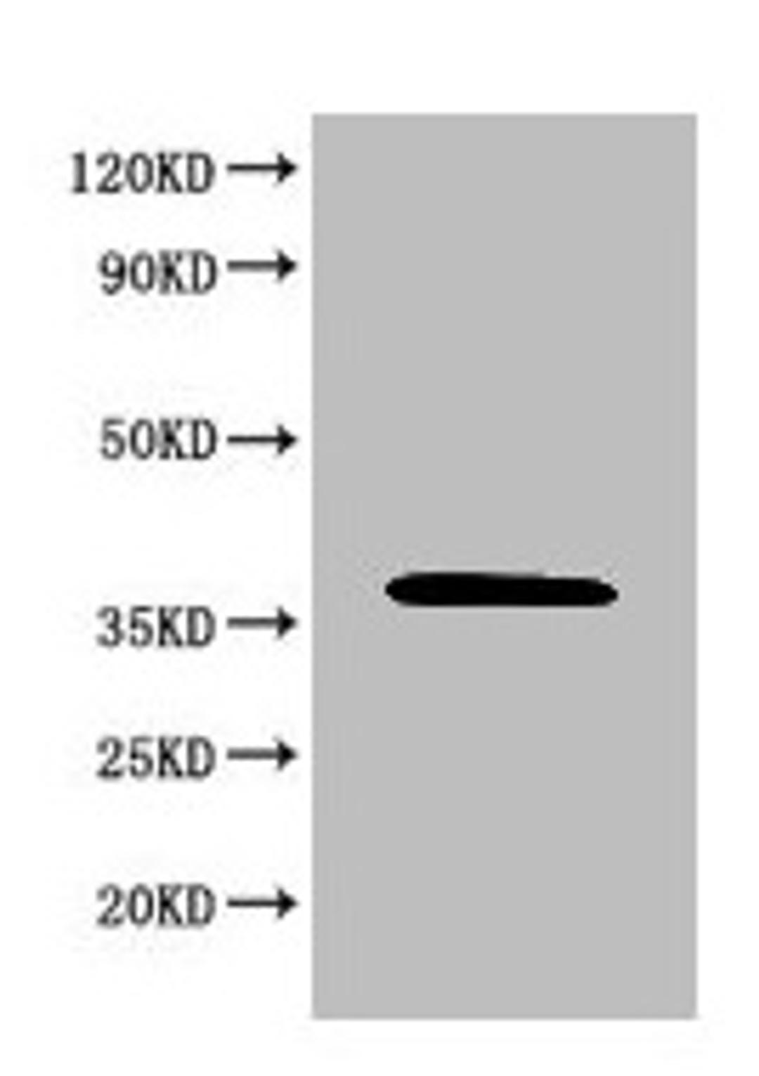 Western Blot. Positive WB detected in: 293T whole cell lysate. All lanes: MAPK8 antibody at 6µg/ml. Secondary. Goat polyclonal to rabbit IgG at 1/50000 dilution. Predicted band size: 49, 45, 36 KDa. Observed band size: 36 KDa