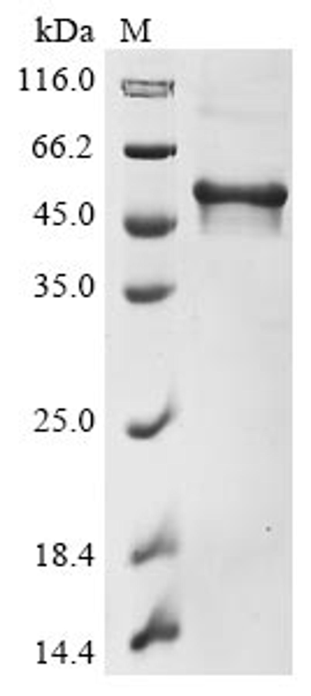(Tris-Glycine gel) Discontinuous SDS-PAGE (reduced) with 5% enrichment gel and 15% separation gel.