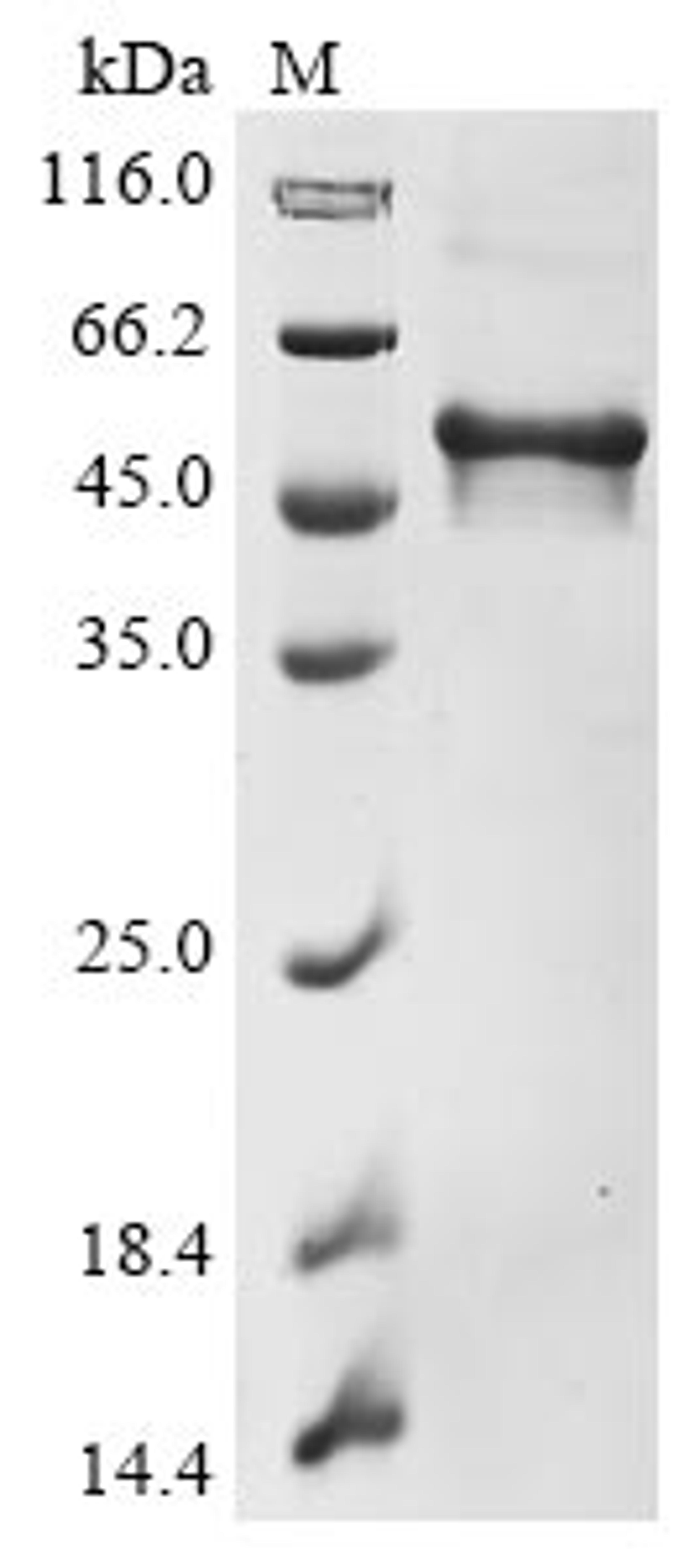 (Tris-Glycine gel) Discontinuous SDS-PAGE (reduced) with 5% enrichment gel and 15% separation gel.