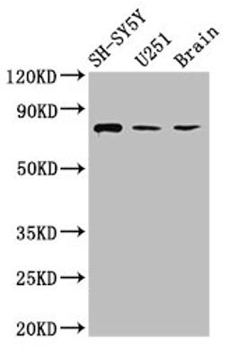 Western Blot. Positive WB detected in: SH-SY5Y whole cell lysate, U251 whole cell lysate, Rat brain tissue. All lanes: NCDN antibody at 2.6µg/ml. Secondary. Goat polyclonal to rabbit IgG at 1/50000 dilution. Predicted band size: 79, 78, 80 kDa. Observed band size: 79 kDa