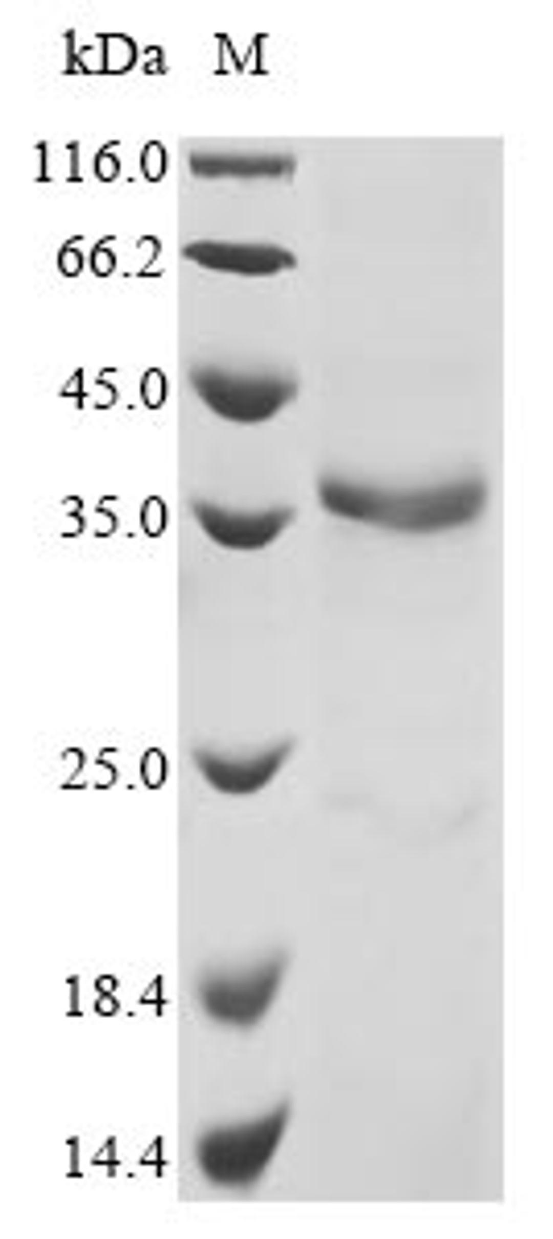 (Tris-Glycine gel) Discontinuous SDS-PAGE (reduced) with 5% enrichment gel and 15% separation gel.