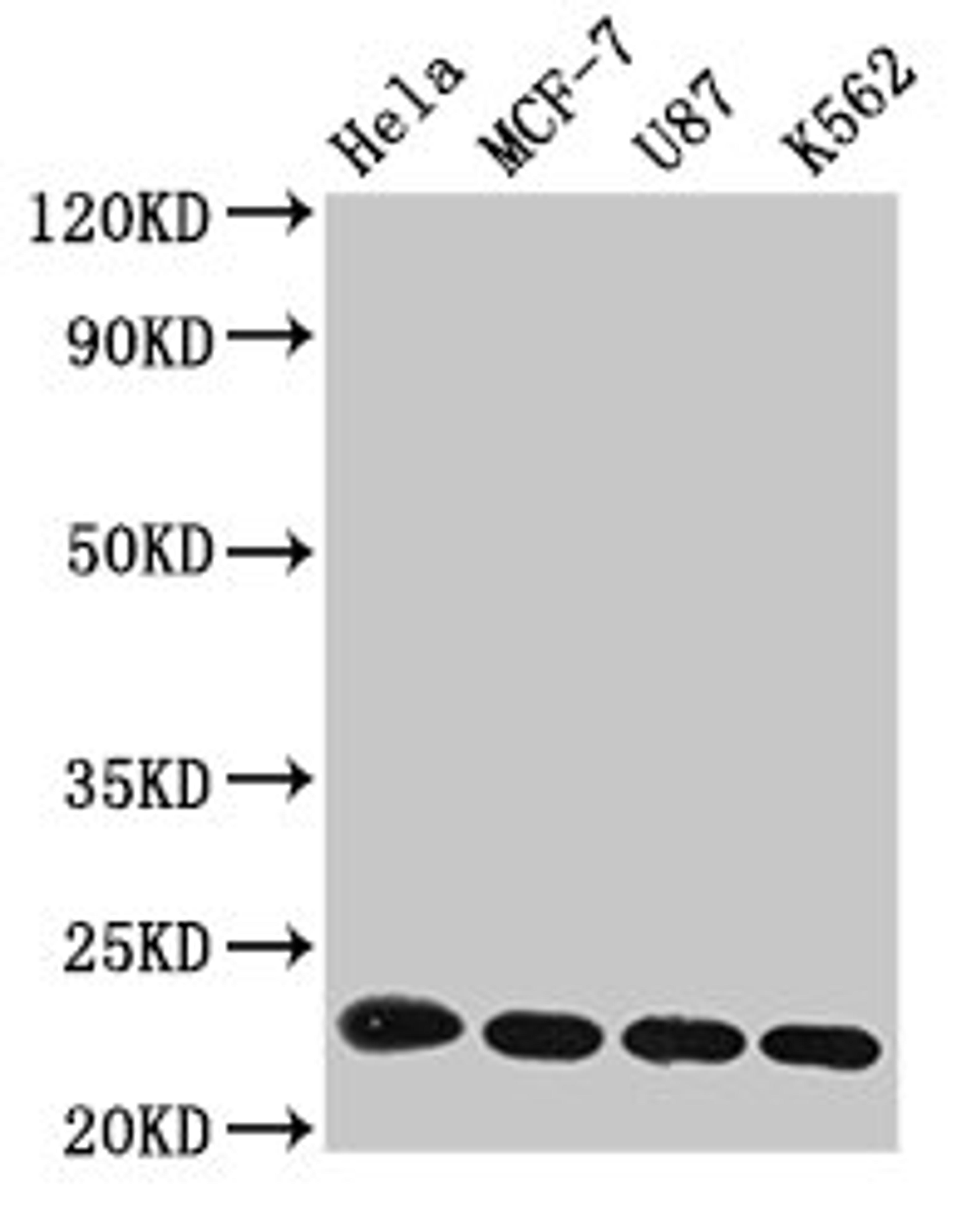 Western Blot. Positive WB detected in: Hela whole cell lysate, MCF-7 whole cell lysate, U87 whole cell lysate, K562 whole cell lysate. All lanes: HIST1H1B antibody at 1µg/ml. Secondary. Goat polyclonal to rabbit IgG at 1/50000 dilution. Predicted band size: 23 kDa. Observed band size: 23 kDa