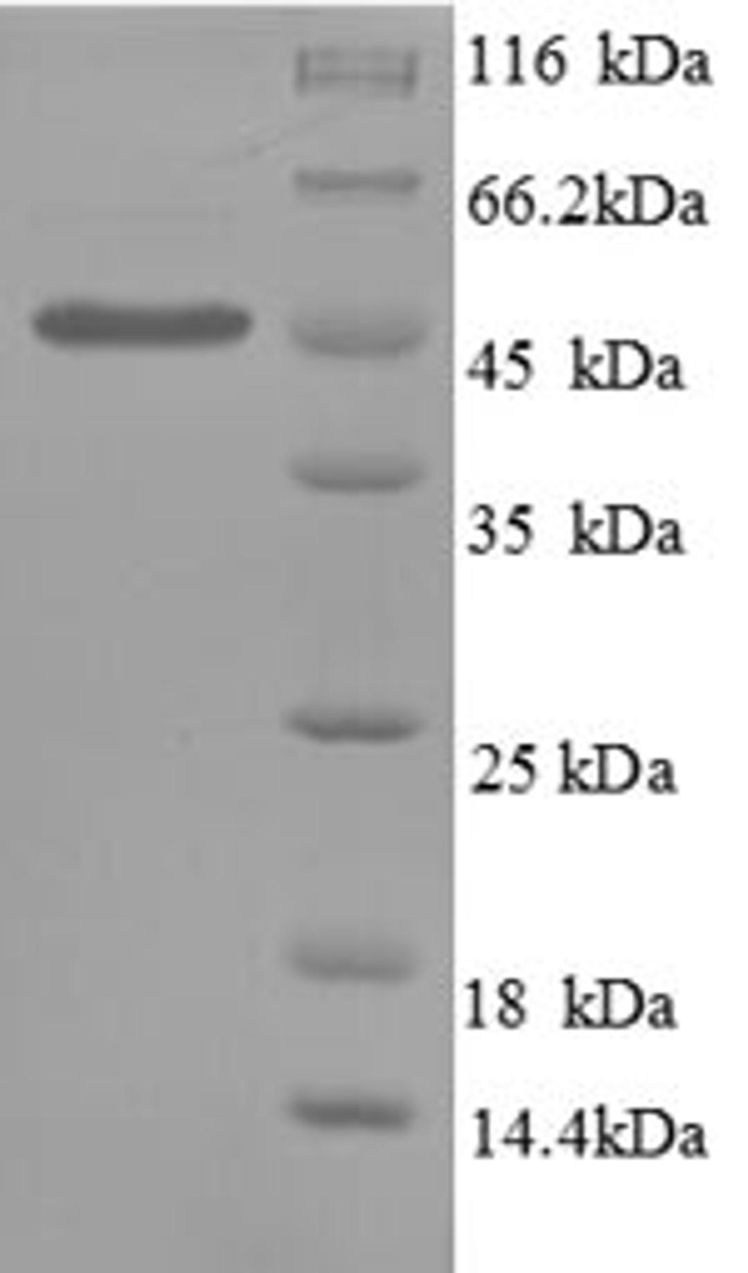 (Tris-Glycine gel) Discontinuous SDS-PAGE (reduced) with 5% enrichment gel and 15% separation gel.