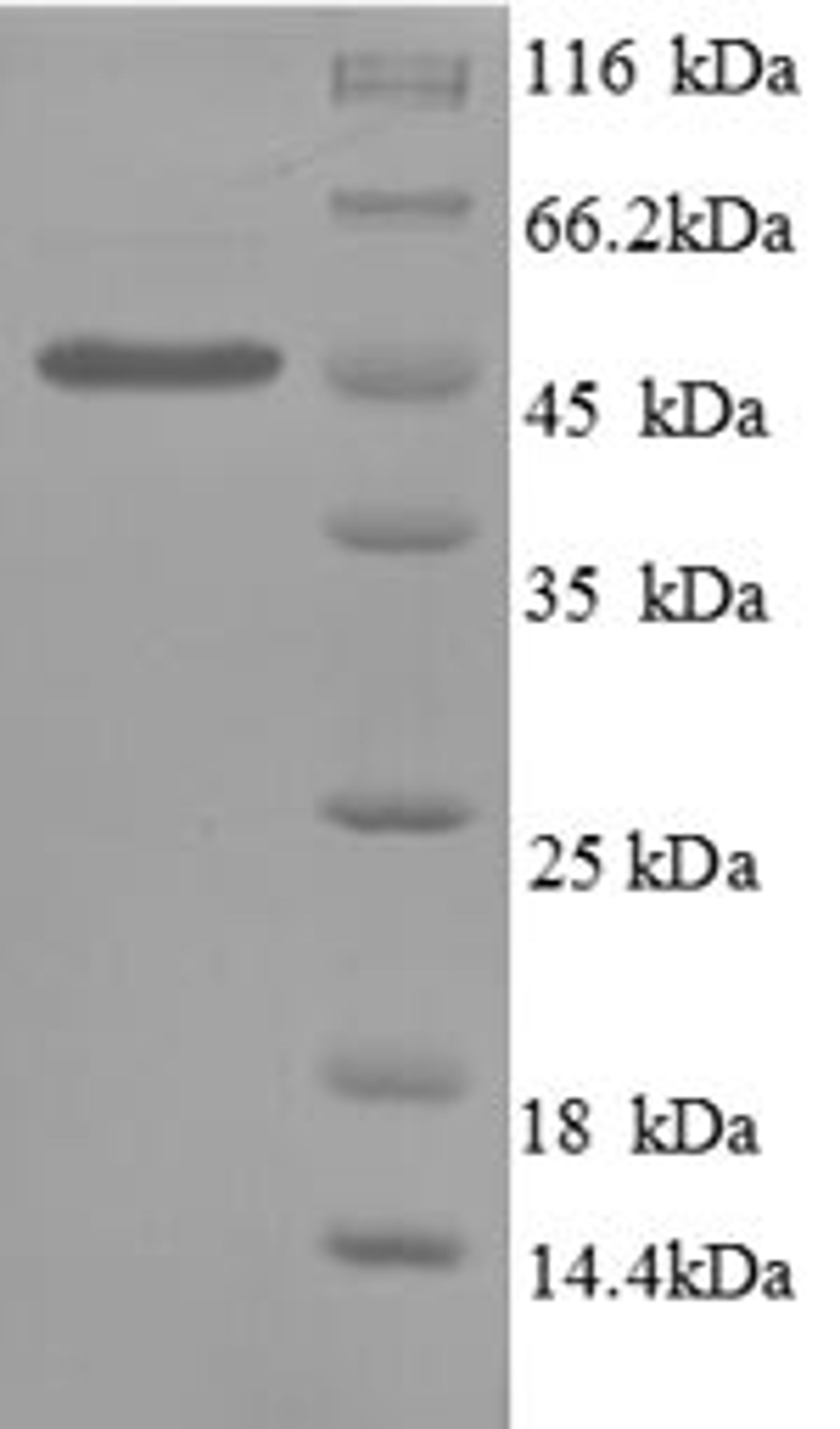 (Tris-Glycine gel) Discontinuous SDS-PAGE (reduced) with 5% enrichment gel and 15% separation gel.