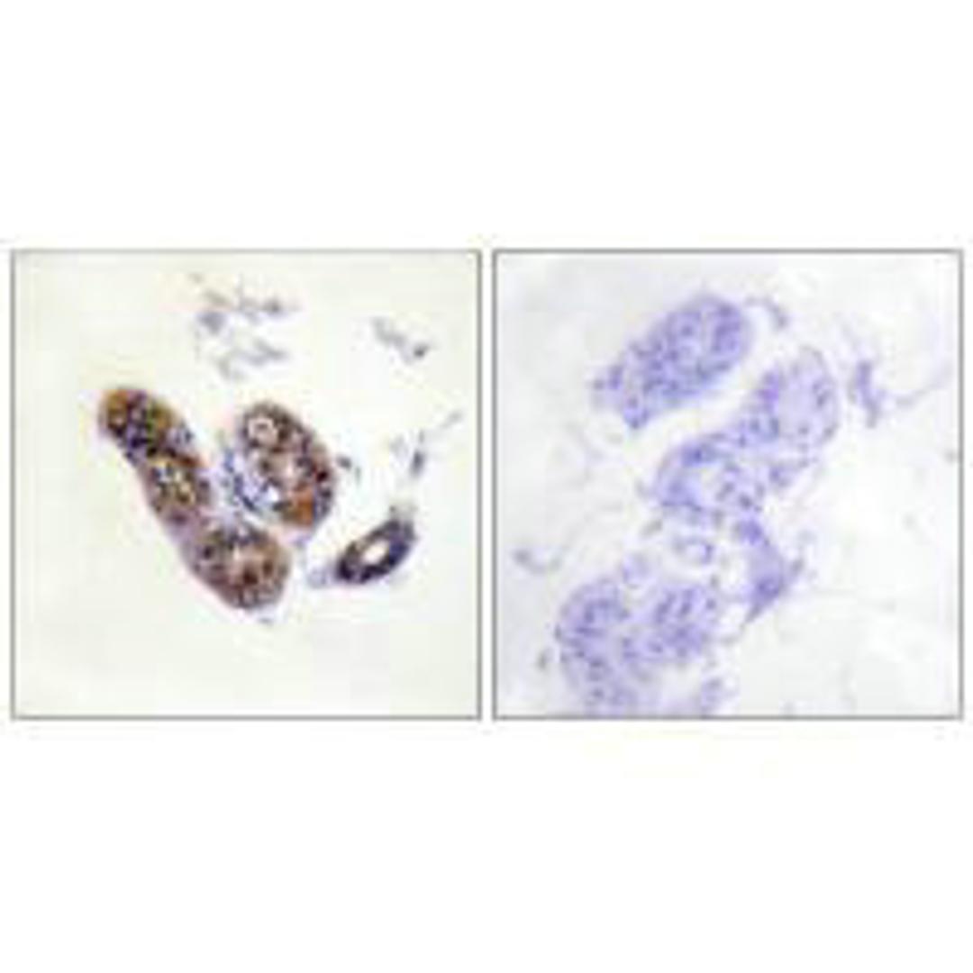 Immunohistochemistry analysis of paraffin-embedded human skin tissue using MITF (Ab-180/73) antibody.