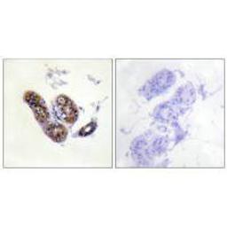 Immunohistochemistry analysis of paraffin-embedded human skin tissue using MITF (Ab-180/73) antibody.