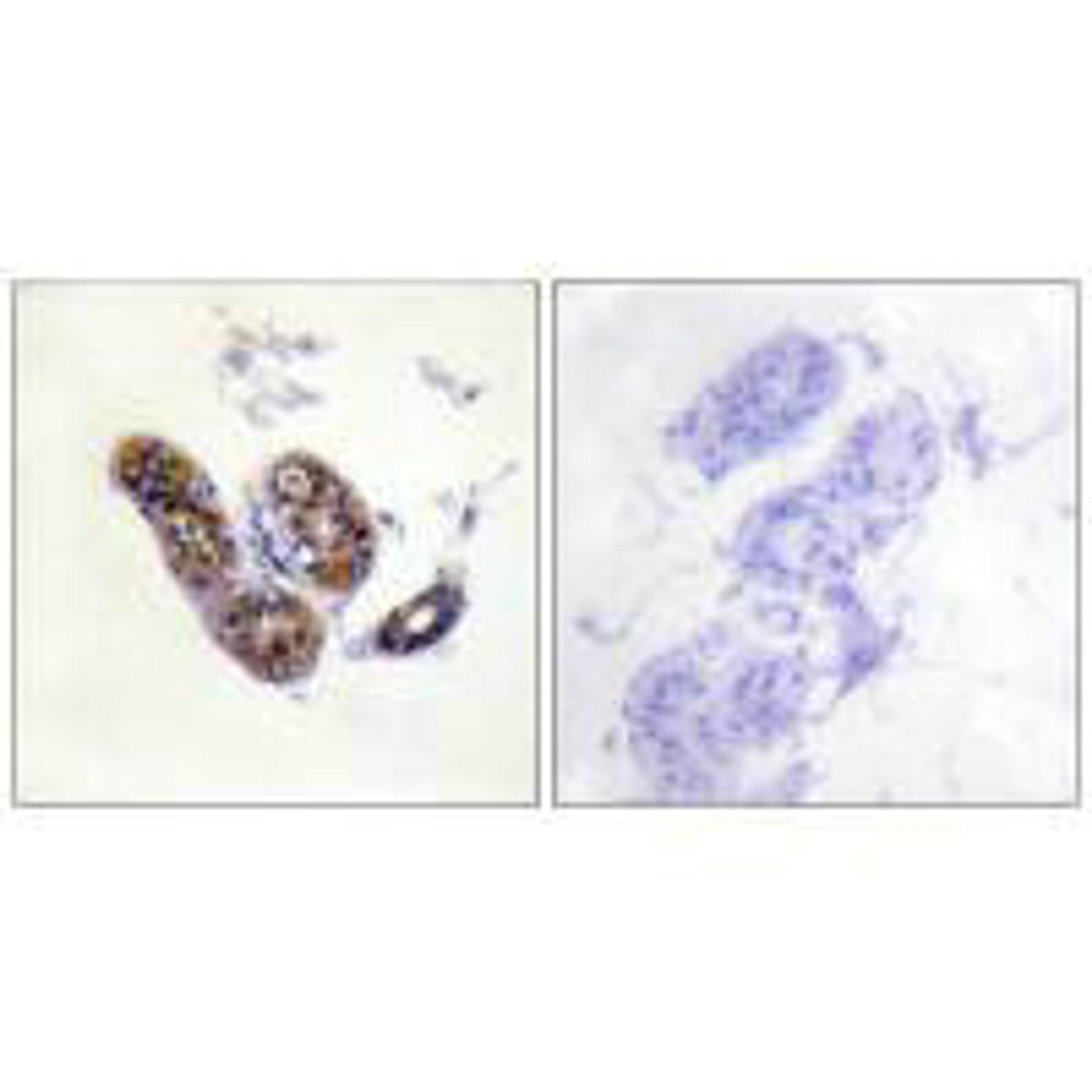 Immunohistochemistry analysis of paraffin-embedded human skin tissue using MITF (Ab-180/73) antibody.