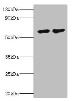 Western blot. All lanes: CYP4F12 antibody at 6ug/ml. Lane 1: Mouse small intestine tissue. Lane 2: Rat liver tissue. Secondary. Goat polyclonal to rabbit IgG at 1/10000 dilution. Predicted band size: 61, 12 kDa. Observed band size: 61 kDa. 