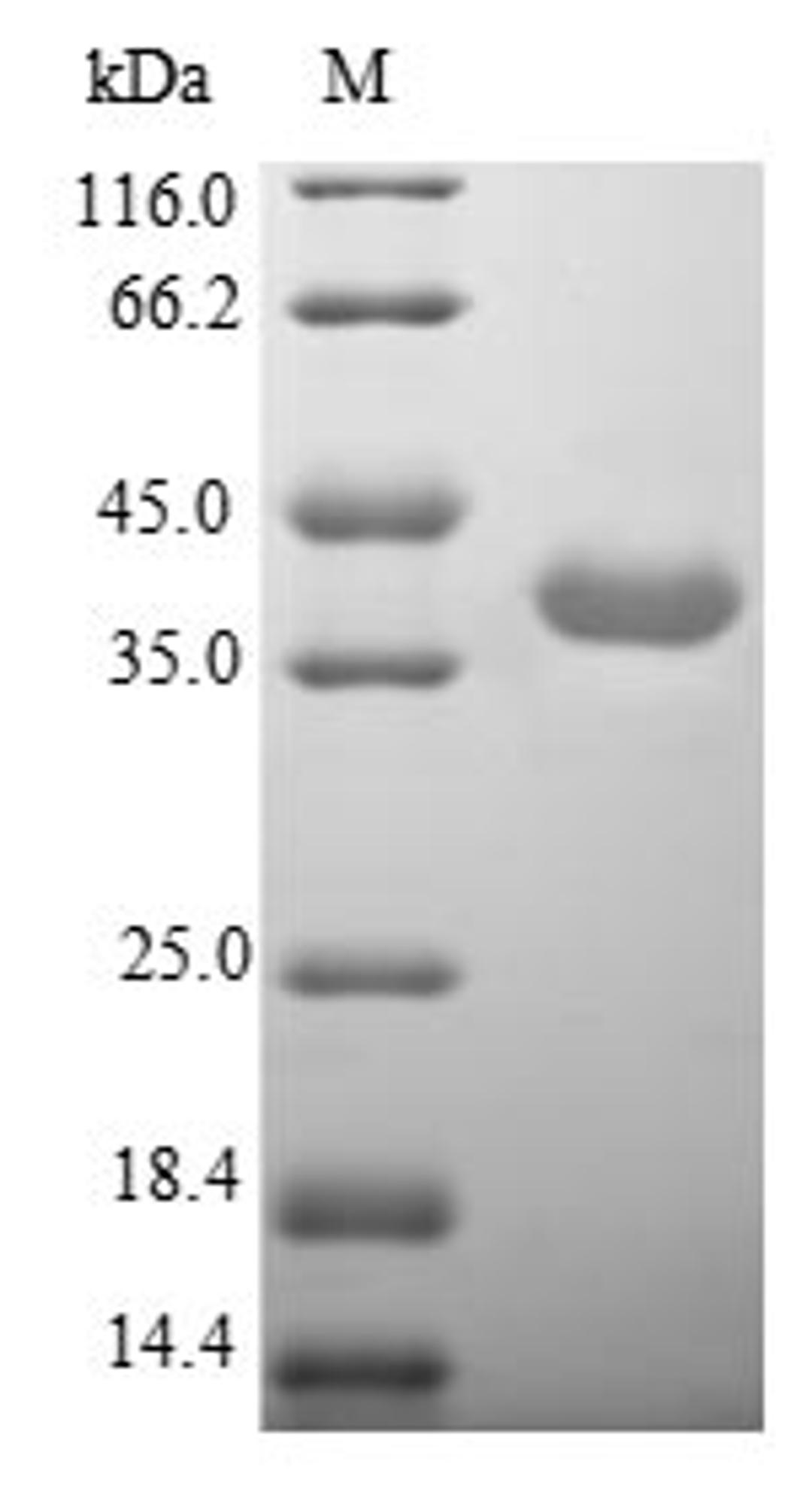 (Tris-Glycine gel) Discontinuous SDS-PAGE (reduced) with 5% enrichment gel and 15% separation gel.