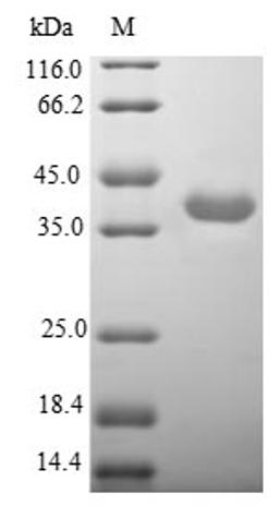 (Tris-Glycine gel) Discontinuous SDS-PAGE (reduced) with 5% enrichment gel and 15% separation gel.