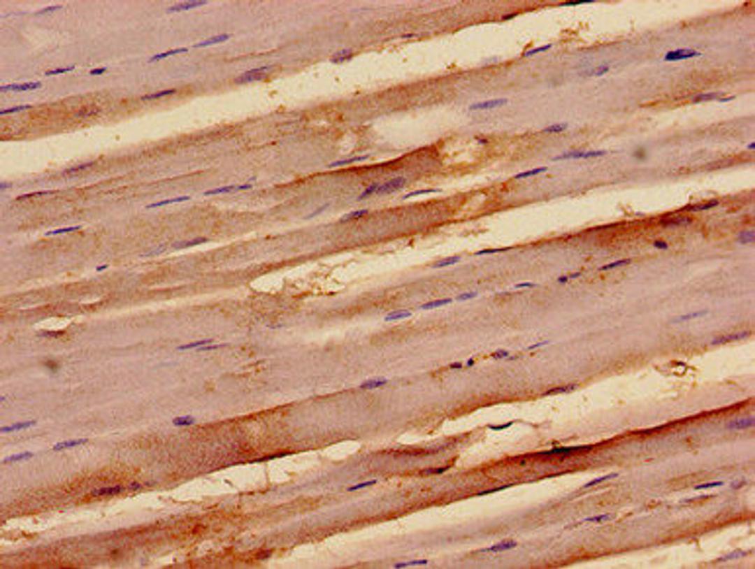 Immunohistochemistry analysis of human skeletal muscle tissue using CSB-PA850806LA01HU at dilution of 1:100