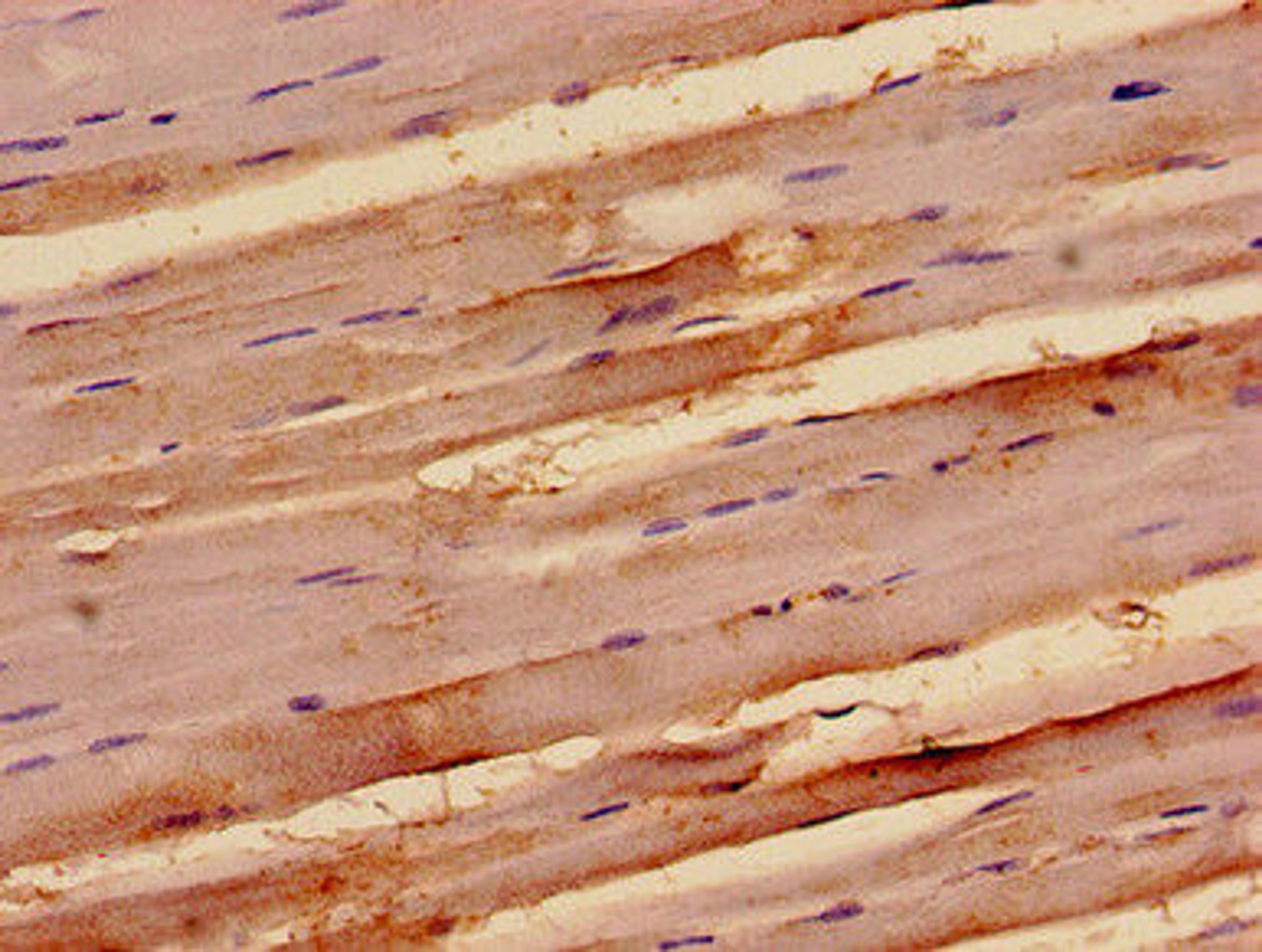 Immunohistochemistry analysis of human skeletal muscle tissue using CSB-PA850806LA01HU at dilution of 1:100