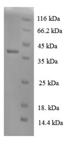 (Tris-Glycine gel) Discontinuous SDS-PAGE (reduced) with 5% enrichment gel and 15% separation gel.