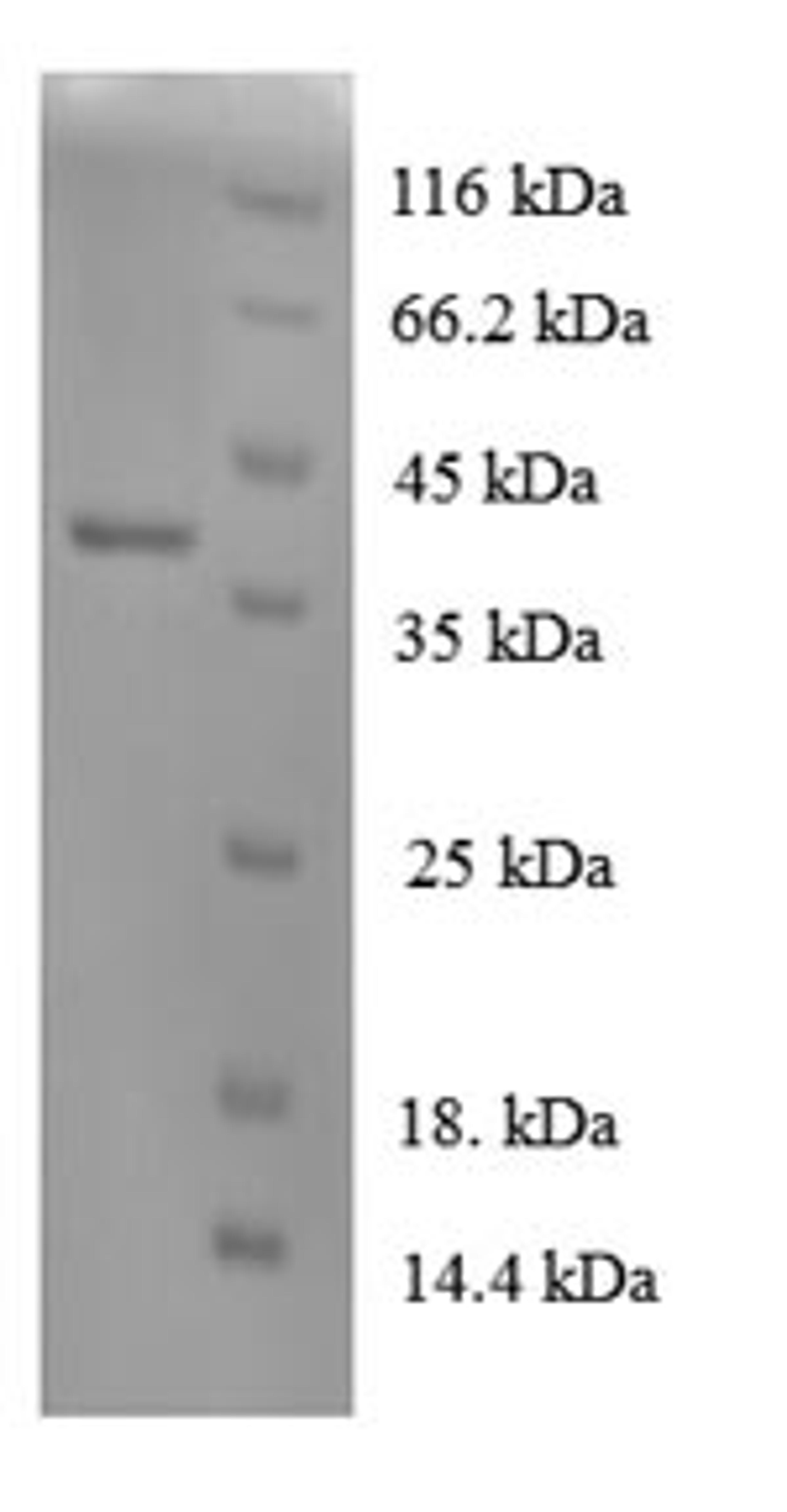 (Tris-Glycine gel) Discontinuous SDS-PAGE (reduced) with 5% enrichment gel and 15% separation gel.