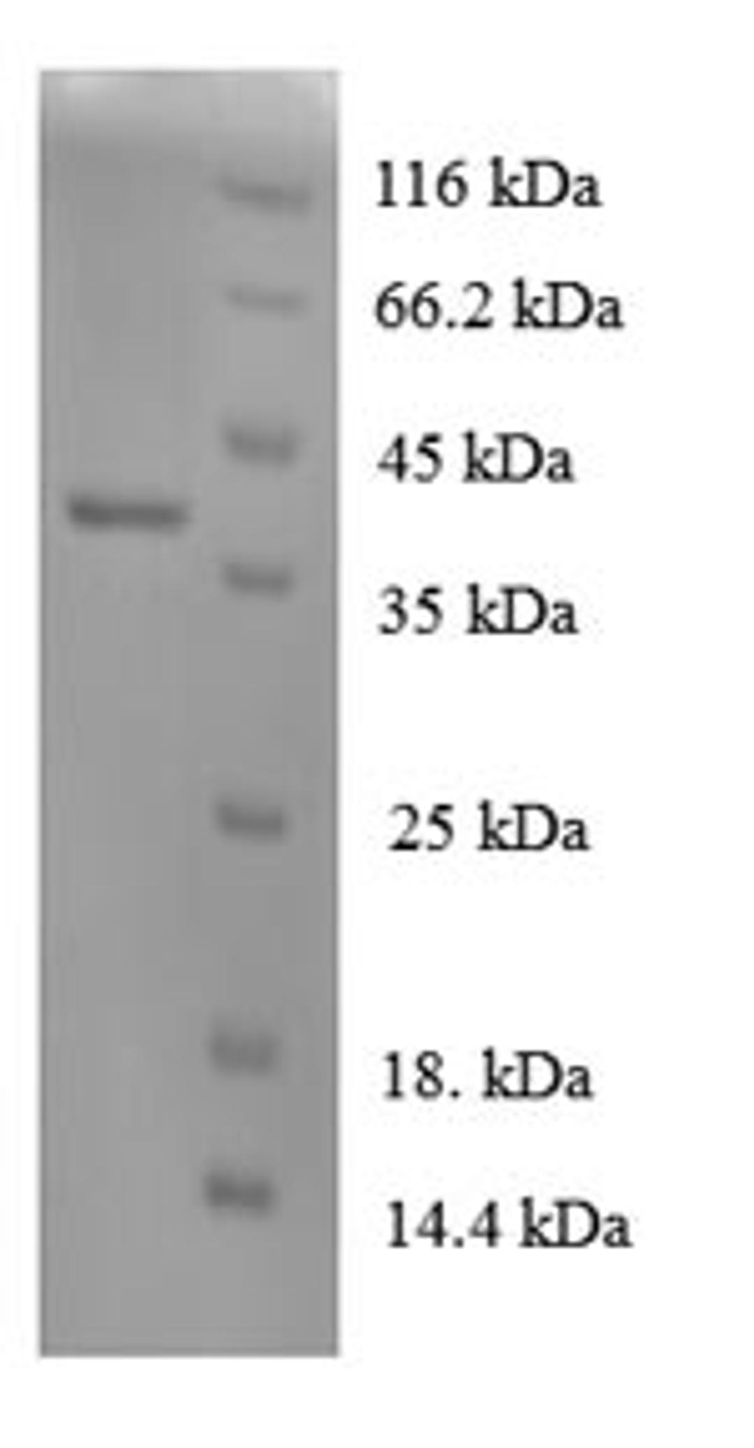 (Tris-Glycine gel) Discontinuous SDS-PAGE (reduced) with 5% enrichment gel and 15% separation gel.