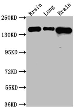 Western Blot. Positive WB detected in: Rat Brain whole cell lysate, Rat Lung whole cell lysate, Mouse Brain whole cell lysate. All lanes: FGFR2 Antibody at 1:1000. Secondary. Goat polyclonal to rabbit IgG at 1/50000 dilution. Predicted band size: 93, 87, 93, 77, 92, 89, 86, 29, 80, 93, 97, 92, 41, 80, 80, 77, 80 kDa. Observed band size: 145 kDa. 
