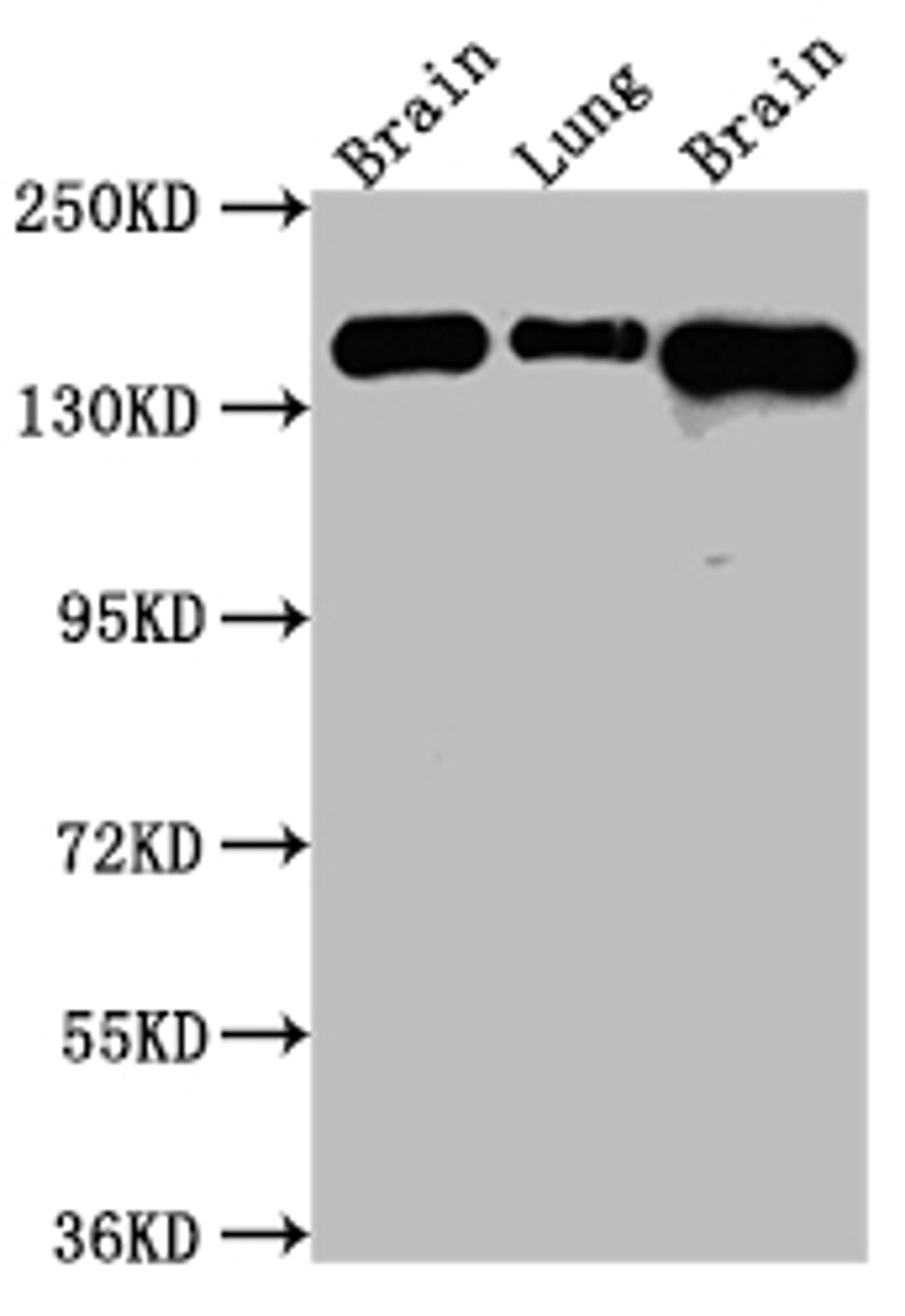 Western Blot. Positive WB detected in: Rat Brain whole cell lysate, Rat Lung whole cell lysate, Mouse Brain whole cell lysate. All lanes: FGFR2 Antibody at 1:1000. Secondary. Goat polyclonal to rabbit IgG at 1/50000 dilution. Predicted band size: 93, 87, 93, 77, 92, 89, 86, 29, 80, 93, 97, 92, 41, 80, 80, 77, 80 kDa. Observed band size: 145 kDa. 