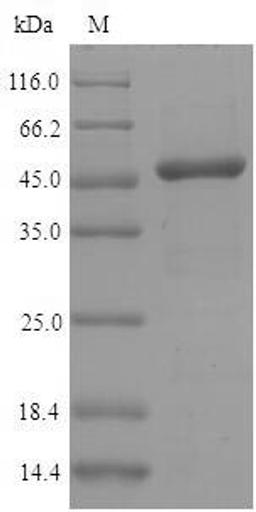 (Tris-Glycine gel) Discontinuous SDS-PAGE (reduced) with 5% enrichment gel and 15% separation gel.