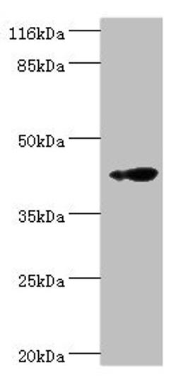 Western blot. All lanes: RNF133 antibody at 2µg/ml + K562 whole cell lysate. Secondary. Goat polyclonal to rabbit IgG at 1/10000 dilution. Predicted band size: 43 kDa. Observed band size: 43 kDa