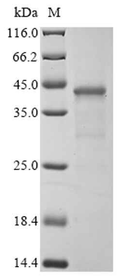 (Tris-Glycine gel) Discontinuous SDS-PAGE (reduced) with 5% enrichment gel and 15% separation gel.
