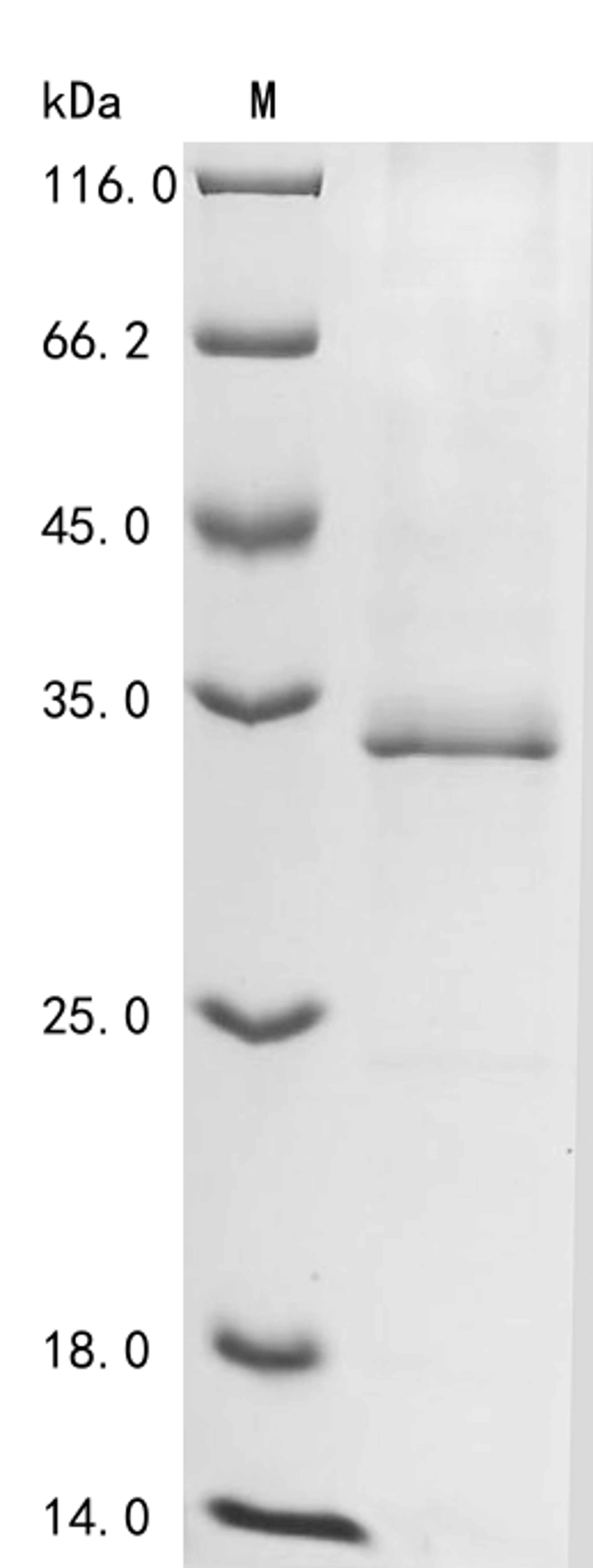 (Tris-Glycine gel) Discontinuous SDS-PAGE (reduced) with 5% enrichment gel and 15% separation gel.